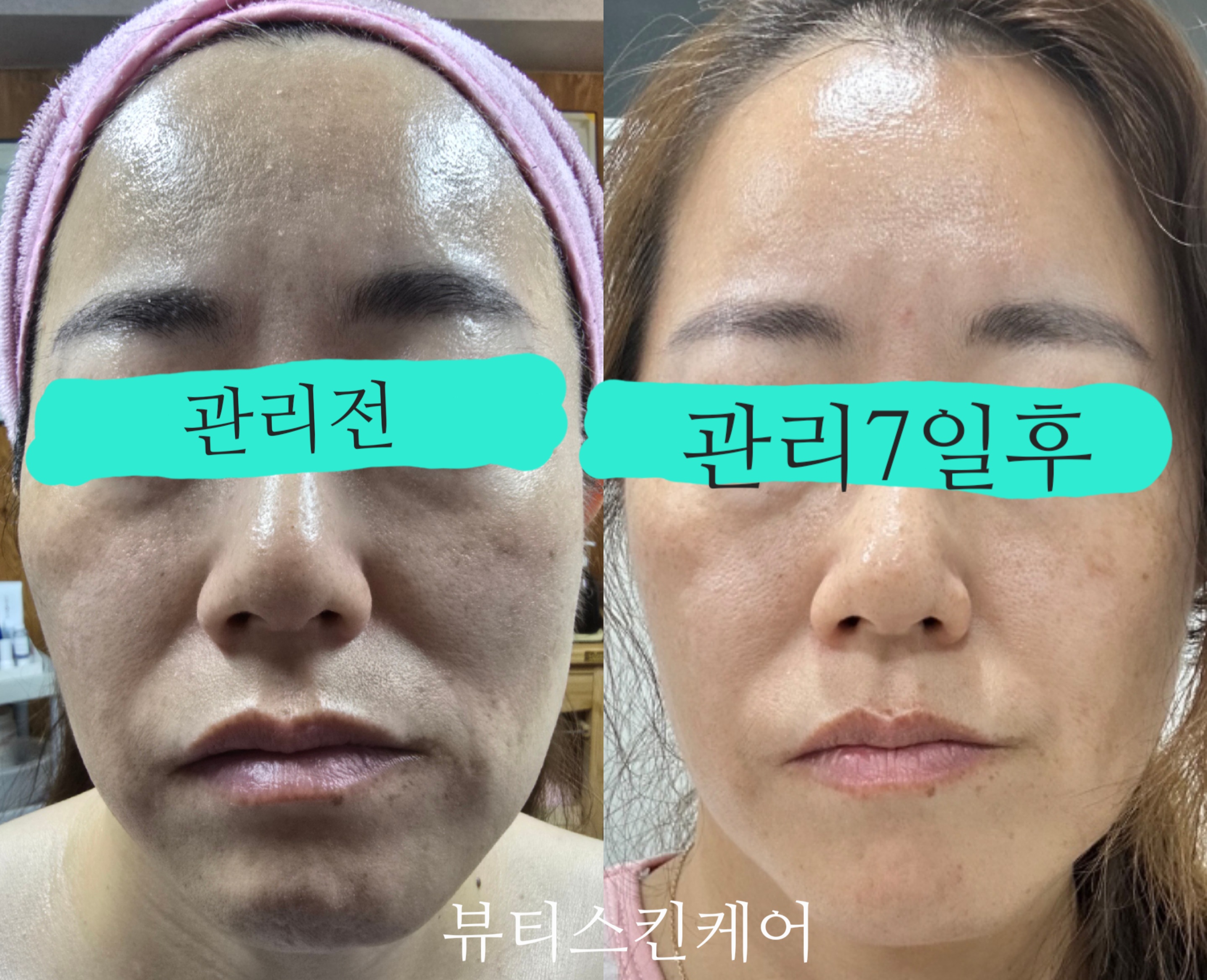뷰티스킨케어 개봉동본점 대표 이미지