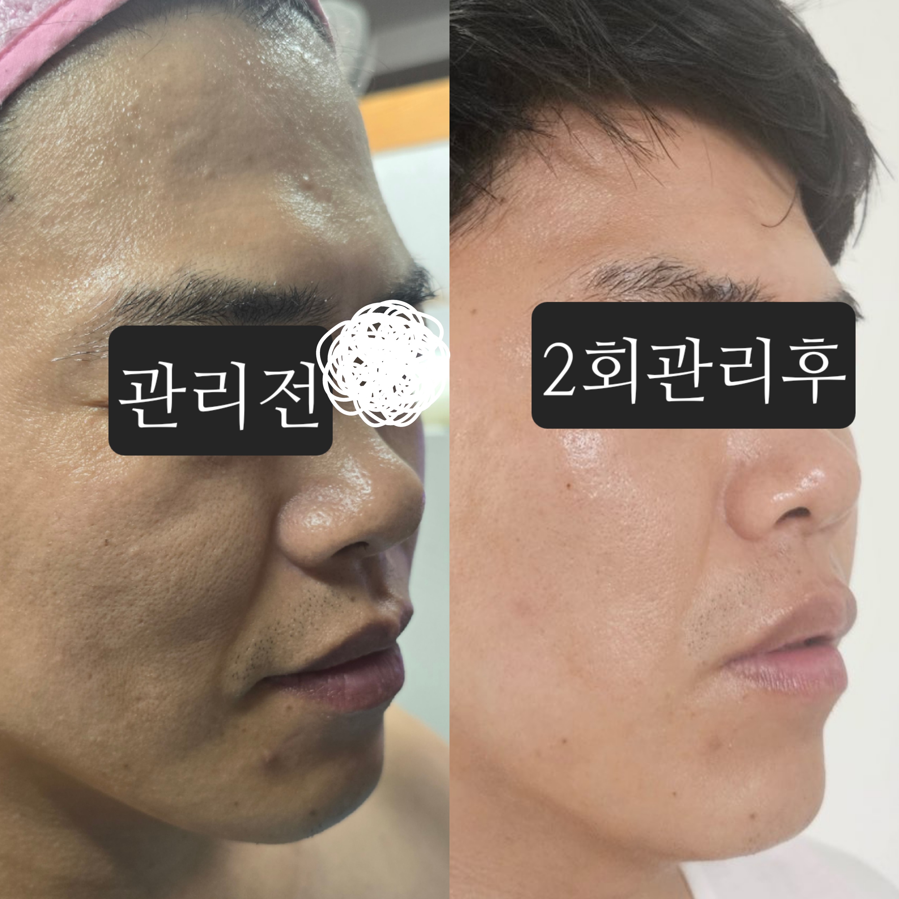 뷰티스킨케어 개봉동본점 대표 이미지