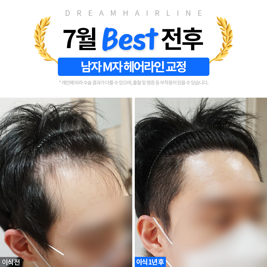 드림헤어라인의원 대표 이미지
