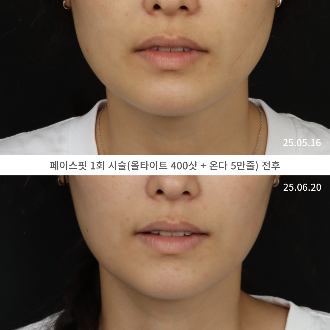로렌의원 대표 이미지