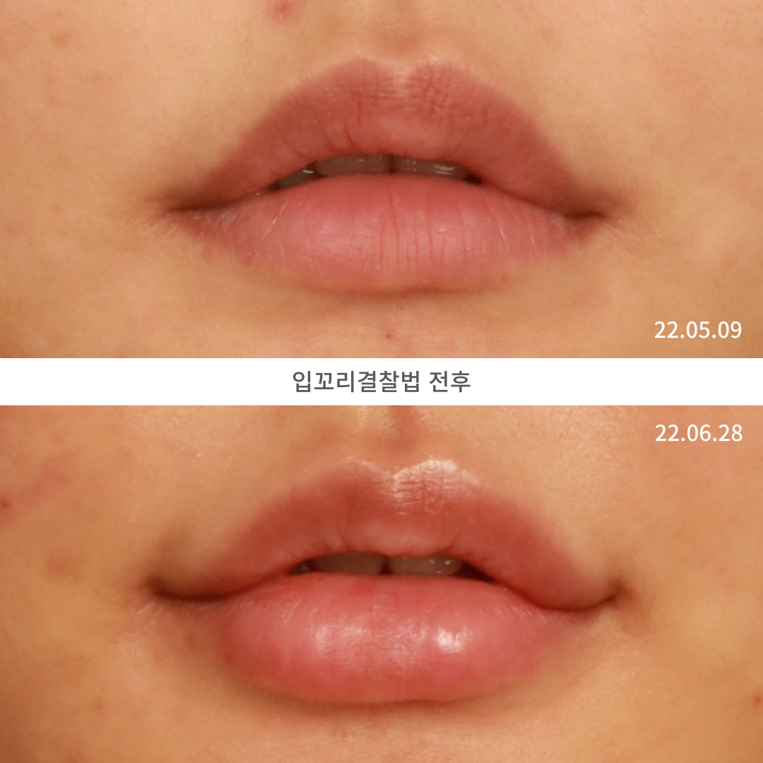 로렌의원 대표 이미지