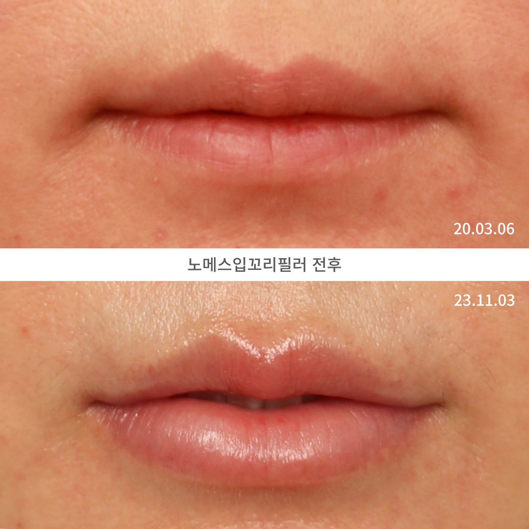 로렌의원 대표 이미지