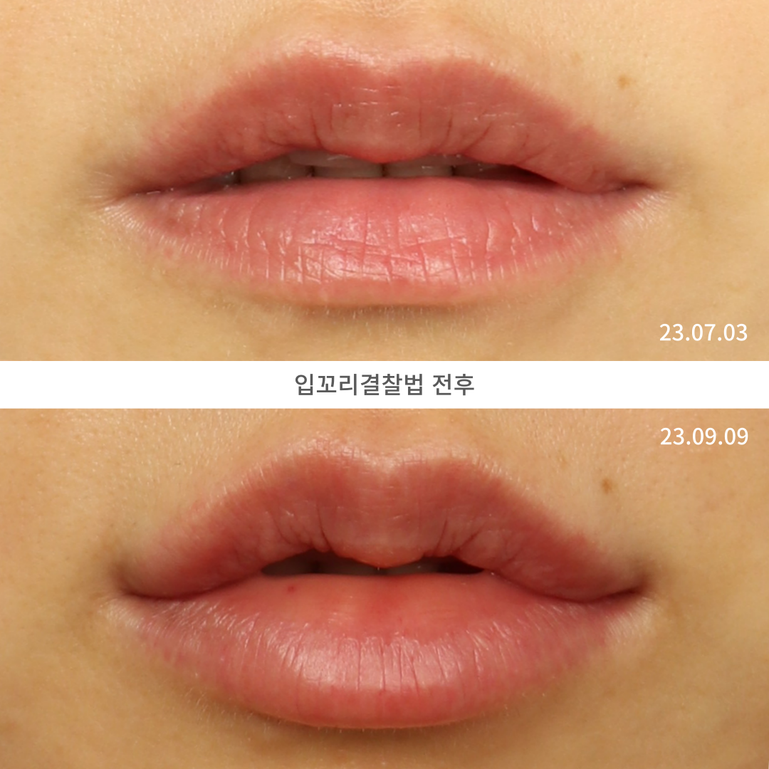 로렌의원 대표 이미지