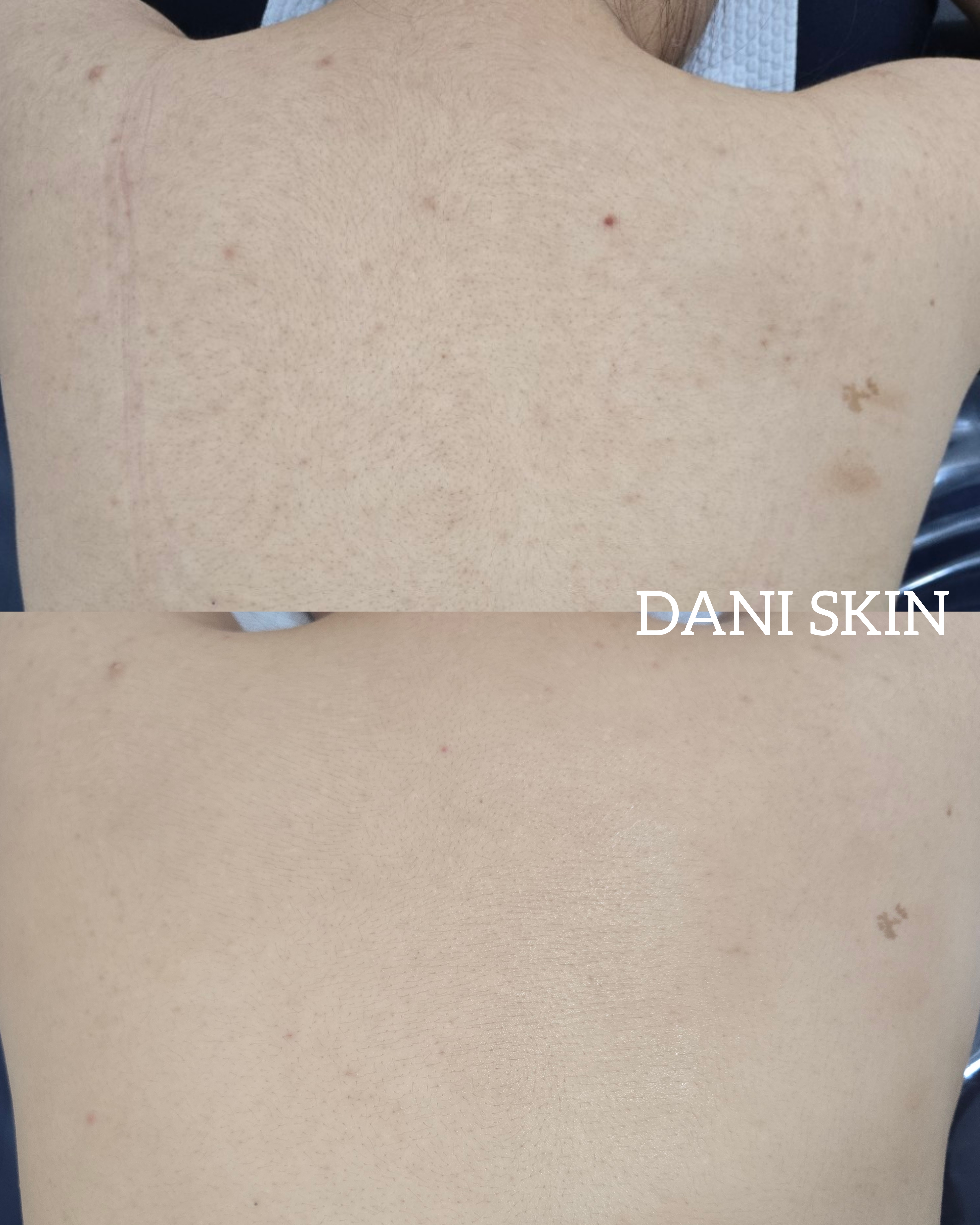 다니스킨 대표 이미지