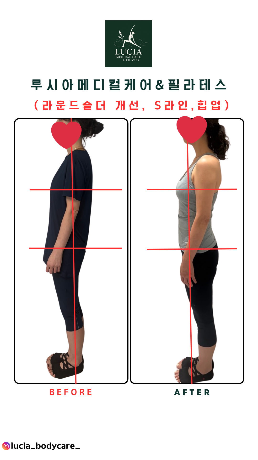 루시아메디컬케어&필라테스 photo 4