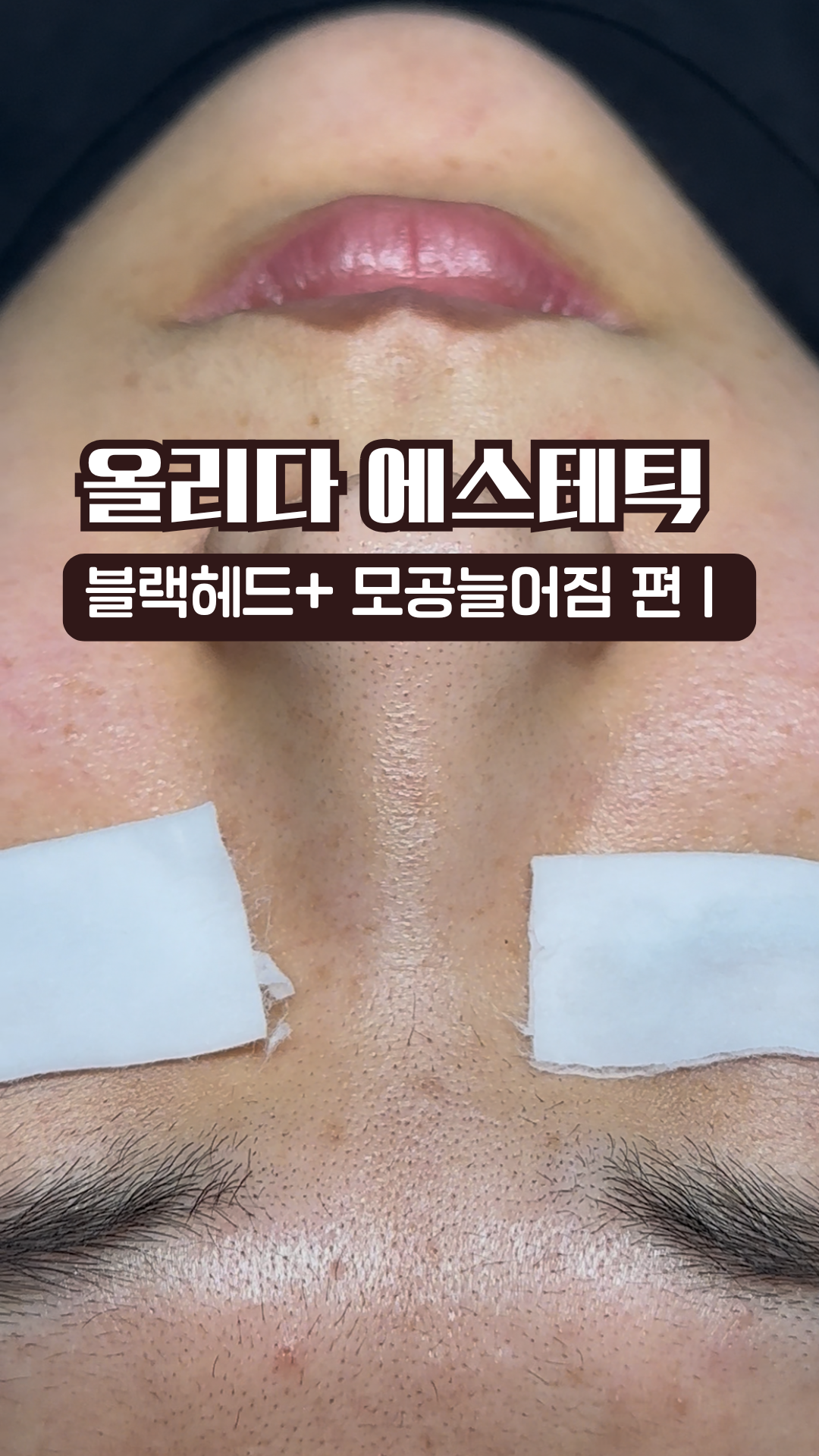 올리다 에스테틱 대표 이미지