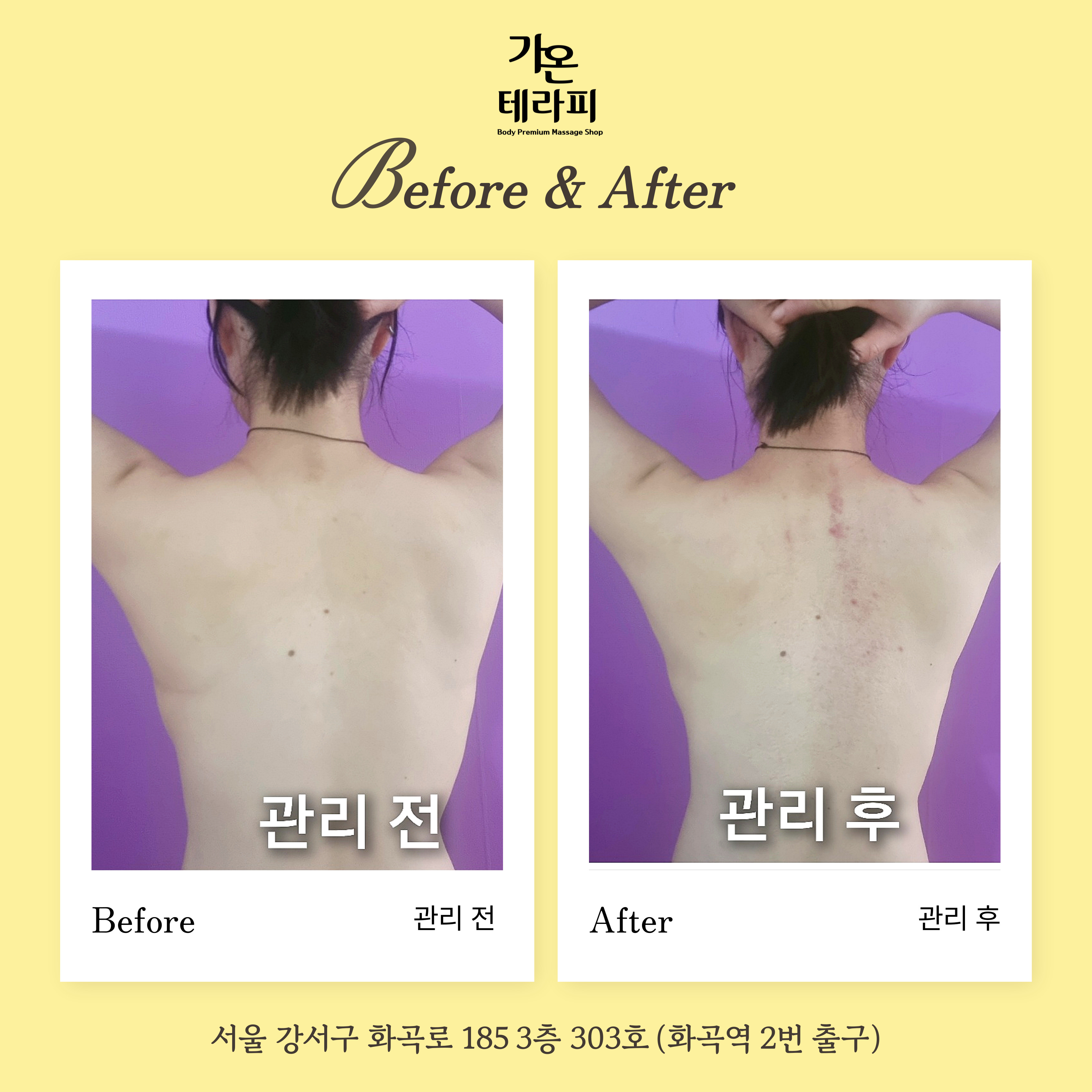 가온테라피 photo 6
