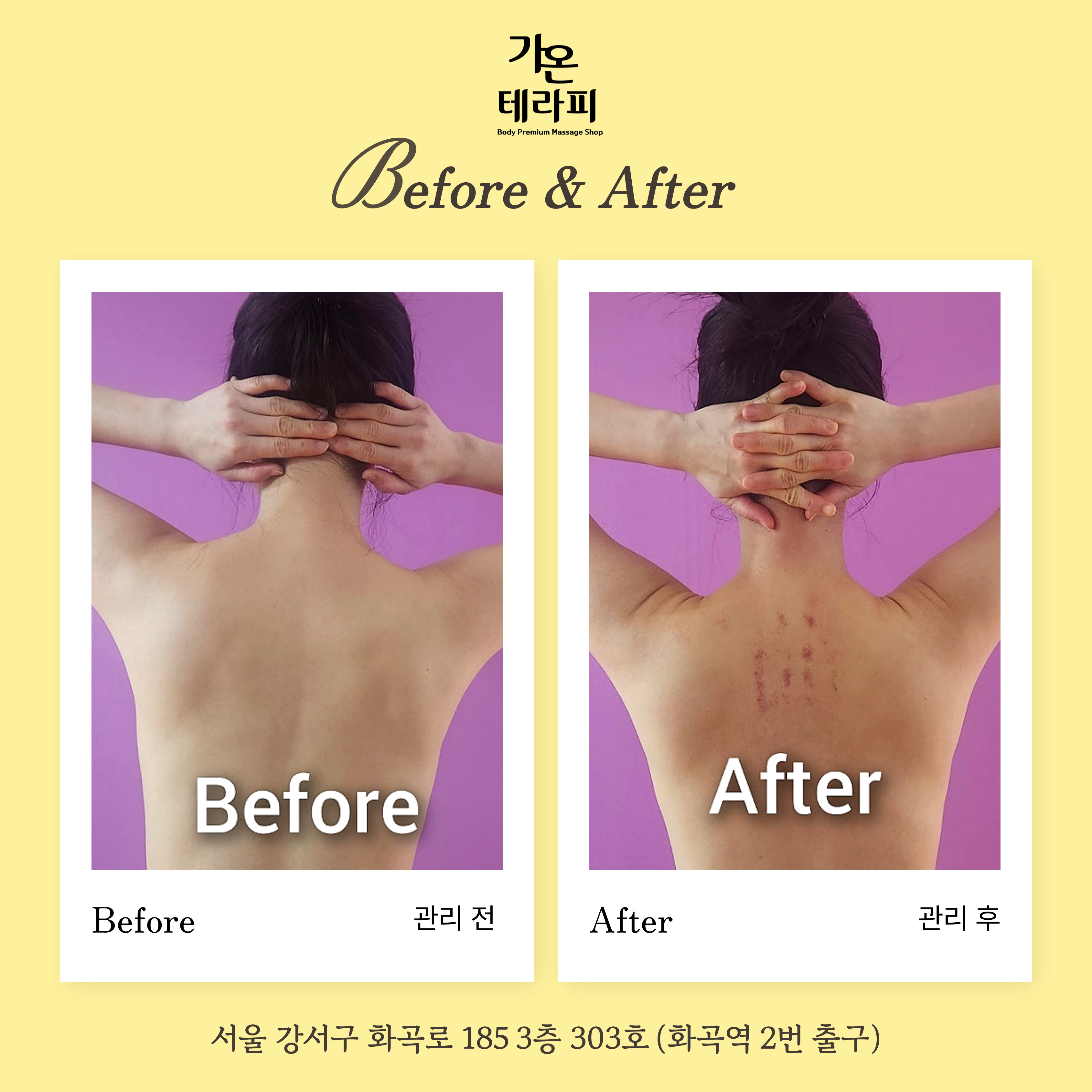 가온테라피 photo 7