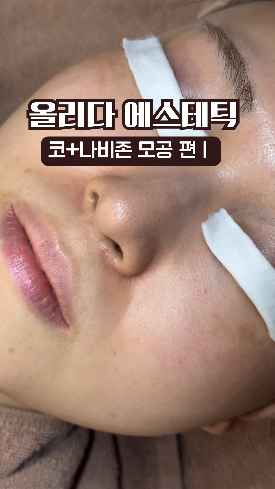 올리다 에스테틱 모공전문센터 수원본점 대표 이미지