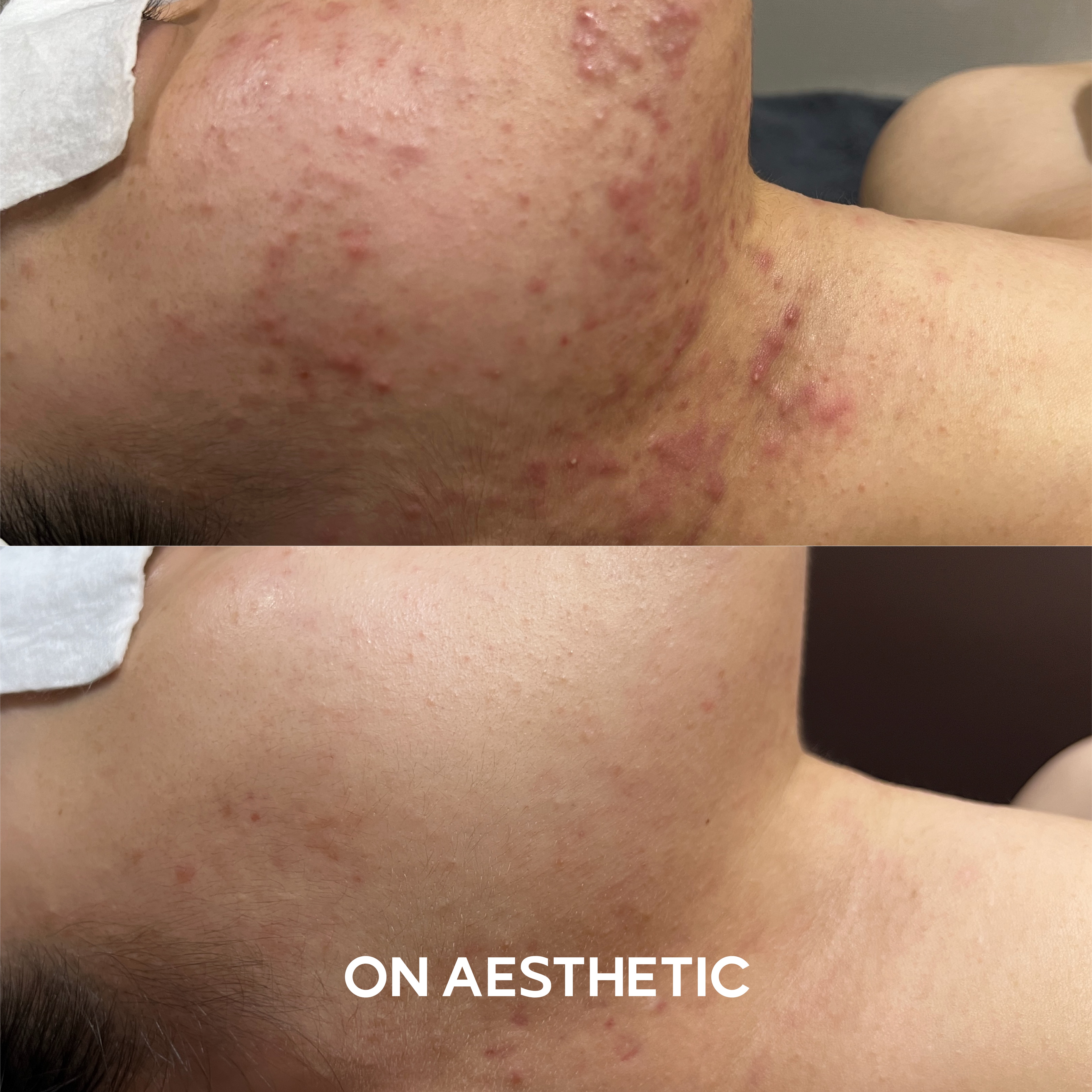 온에스테틱 대표 이미지