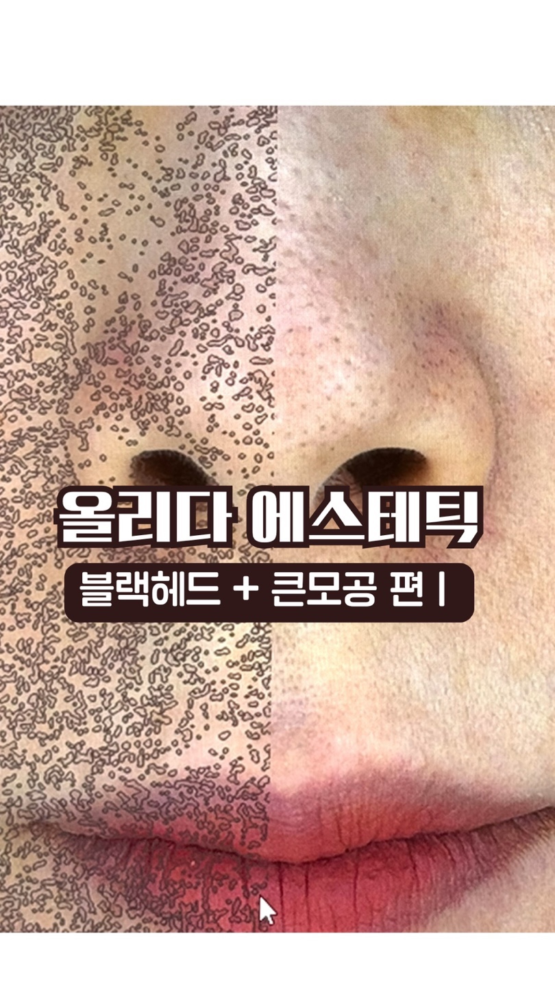 올리다 에스테틱 모공전문센터 강남역점 대표 이미지