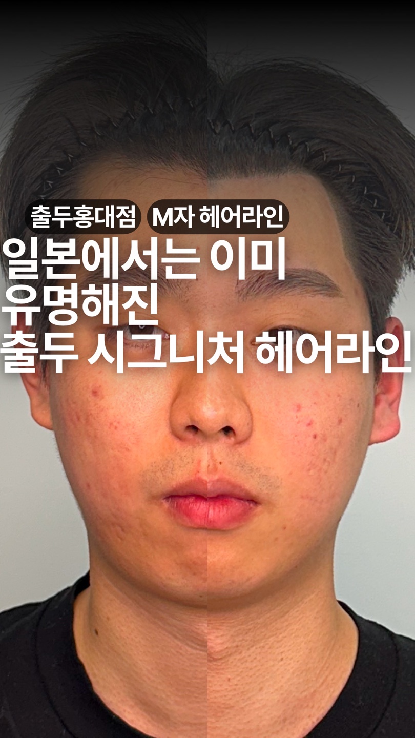 출두SMP 홍대점 대표 이미지