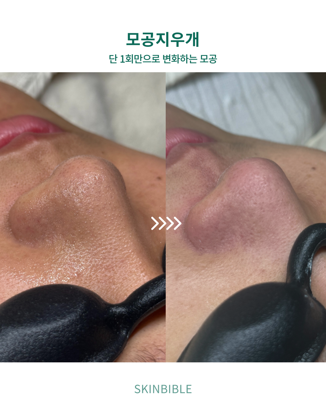 스킨바이블 신도림점 대표 이미지