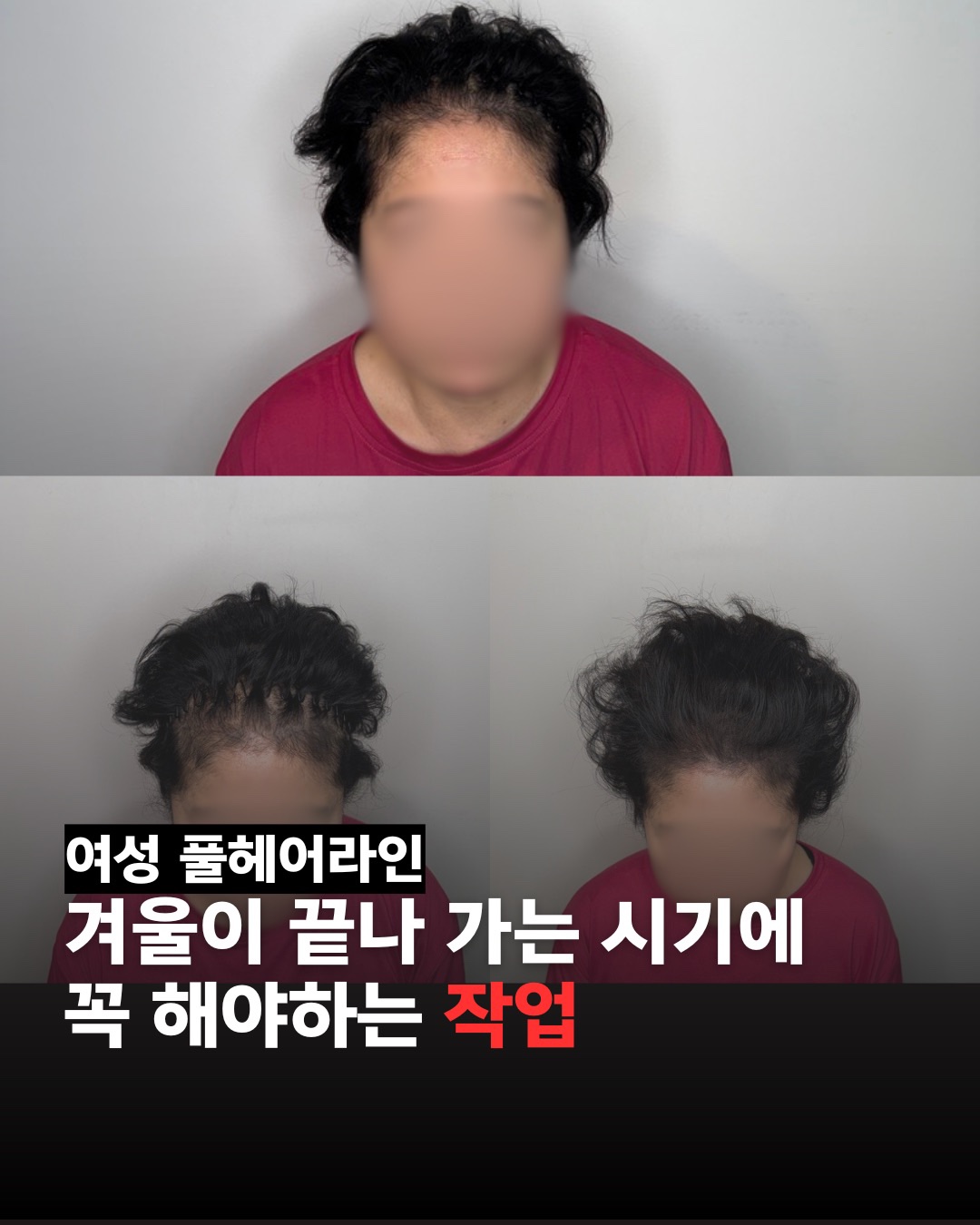 출두SMP 홍대점 대표 이미지