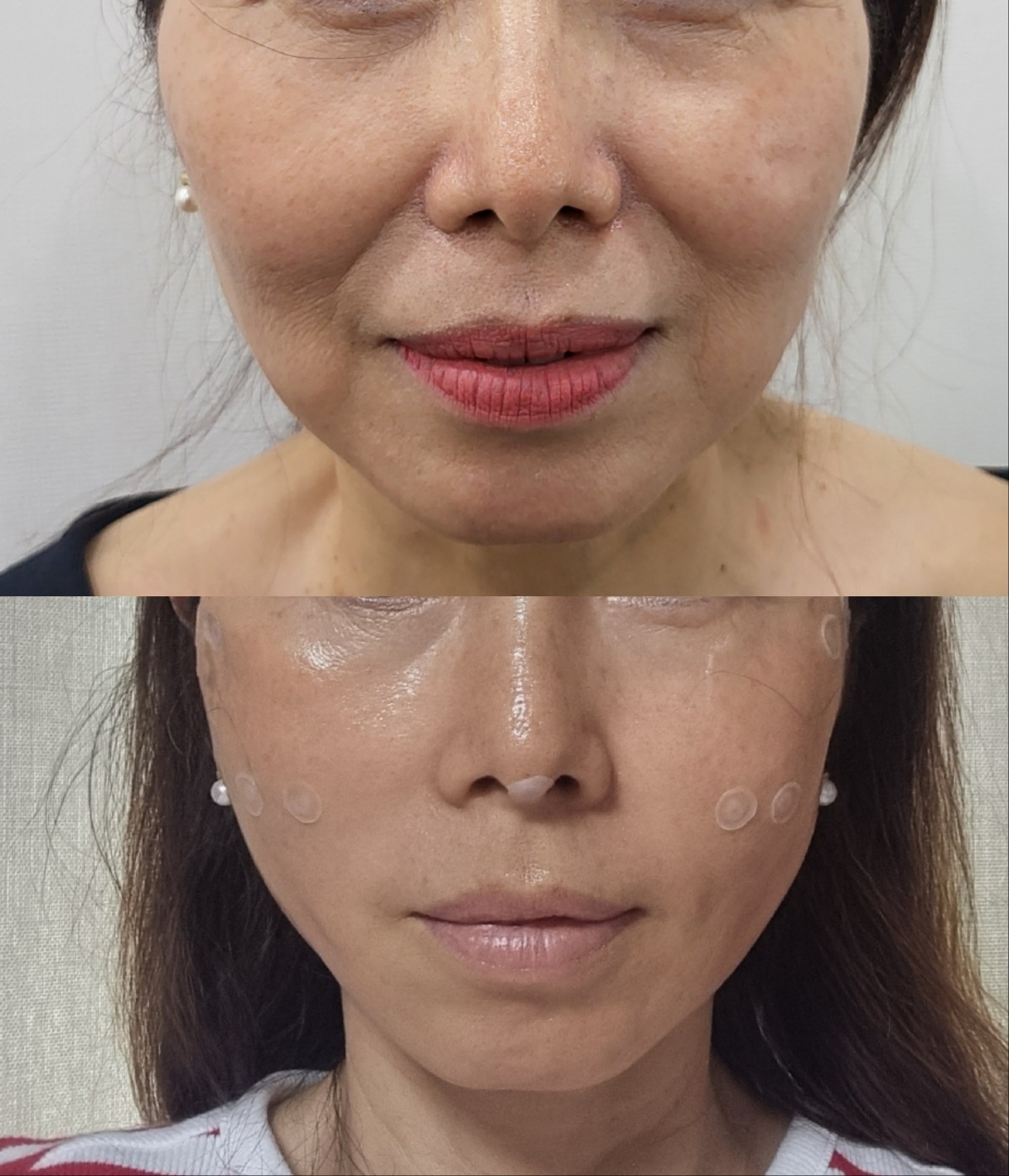 바른치과의원 대표 이미지