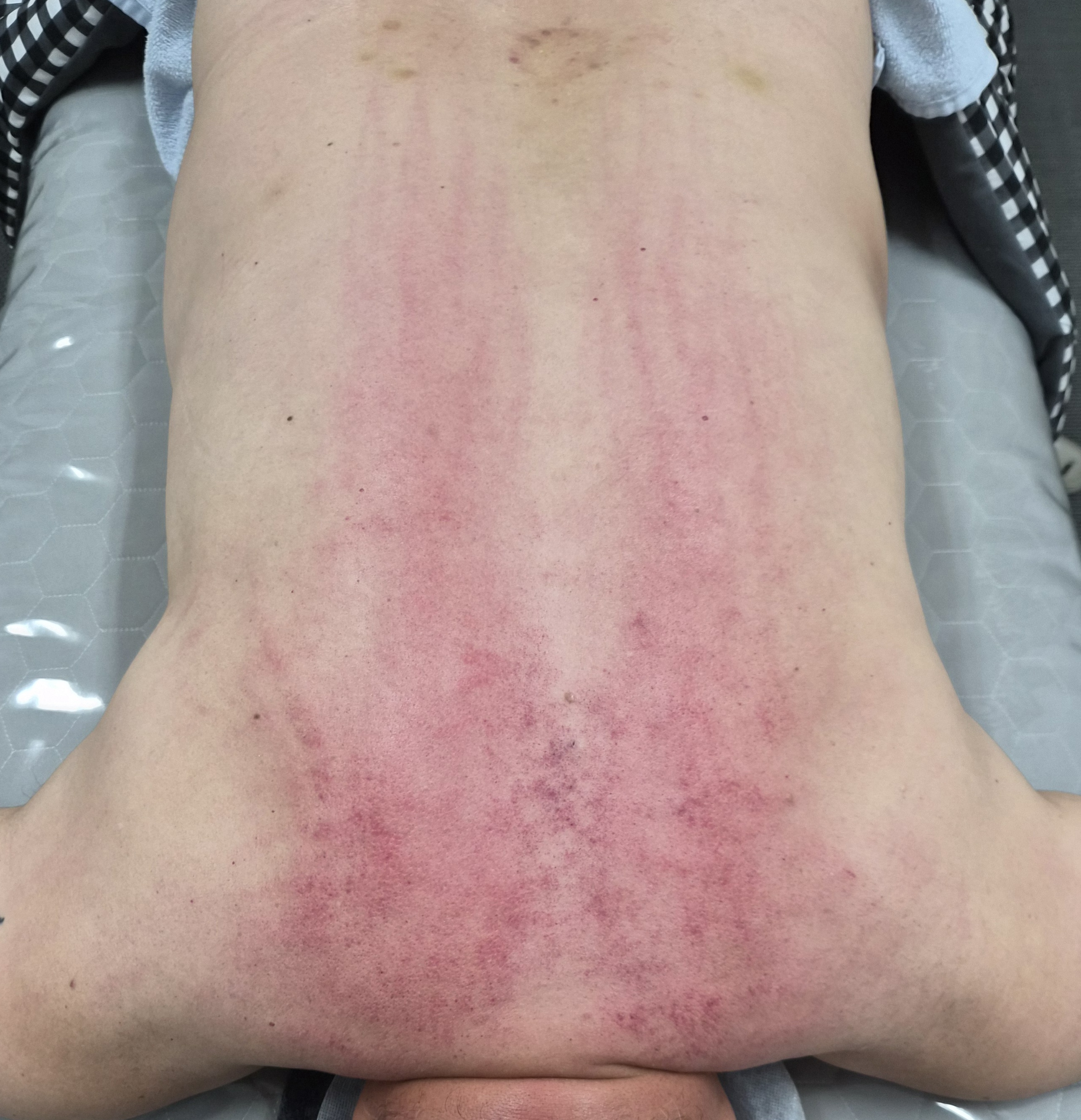 체리베리뷰티 photo 8