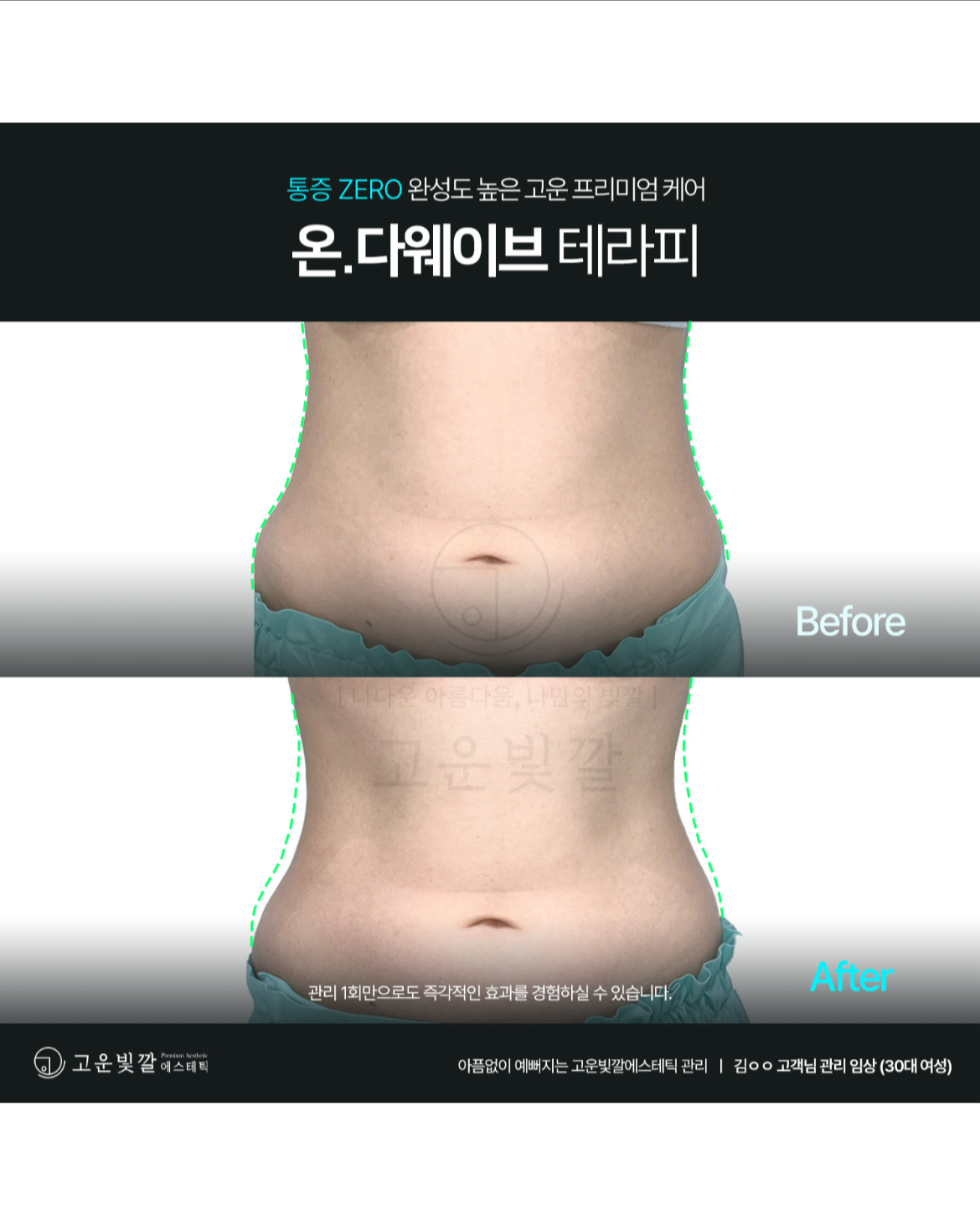 고운빛깔에스테틱 김해장유점 대표 이미지