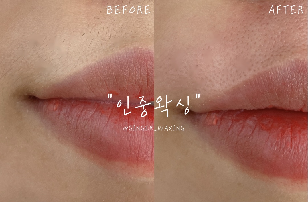 진저뷰티&왁싱 대표 이미지