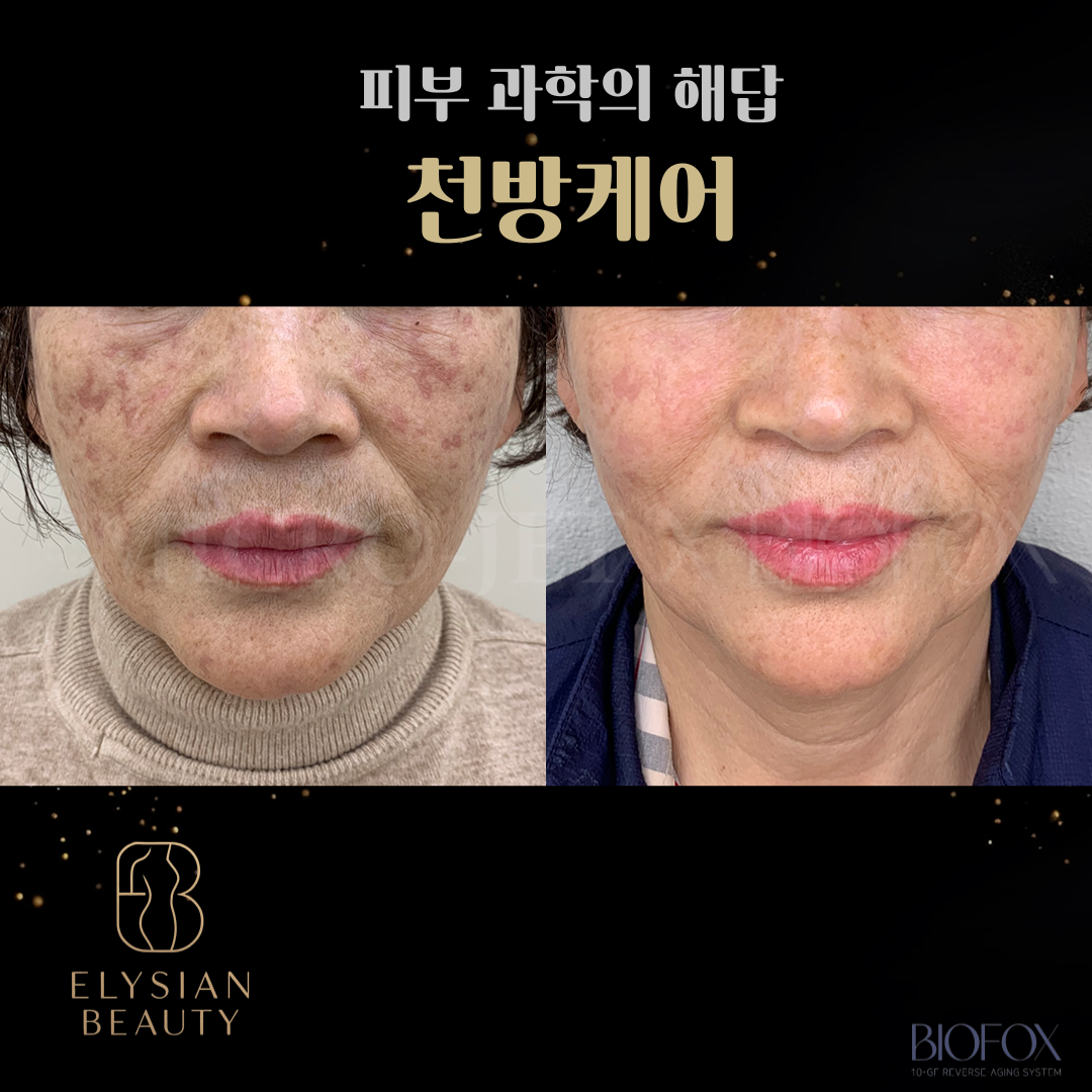 엘리시안뷰티 & 셀스테틱 정자점 photo 8