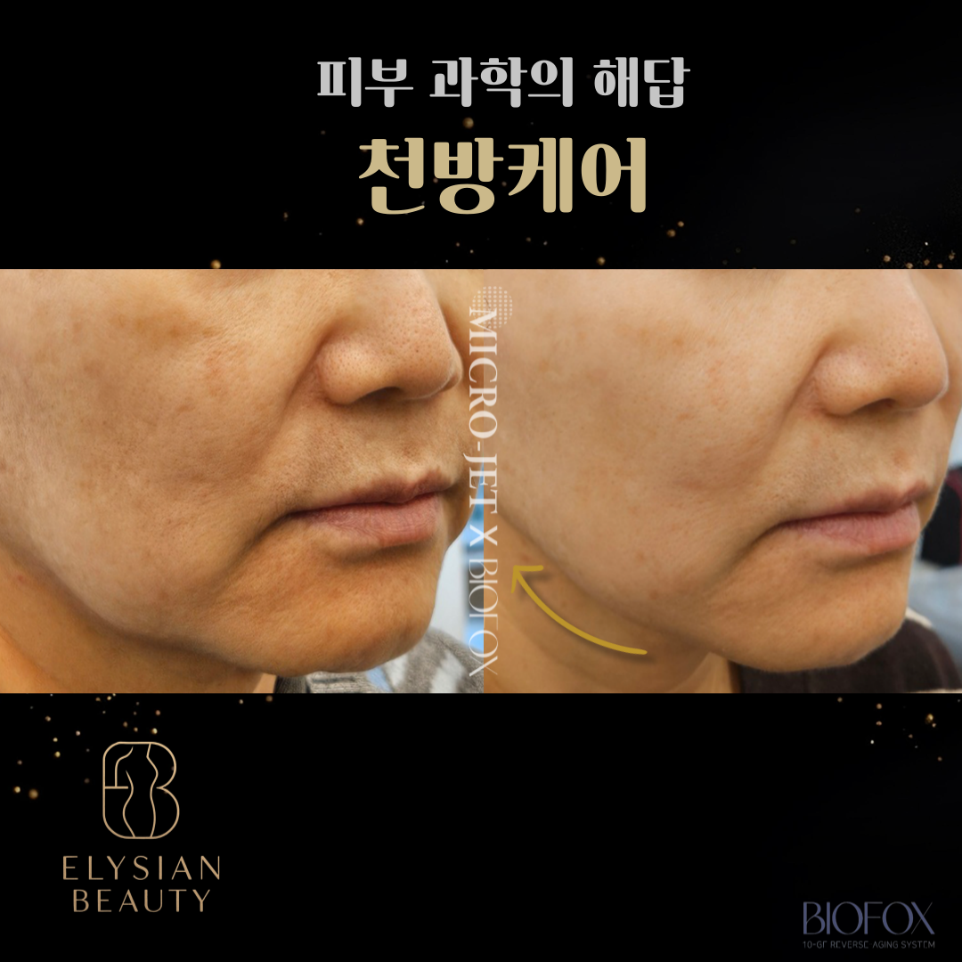 엘리시안뷰티 & 셀스테틱 정자점 photo 9