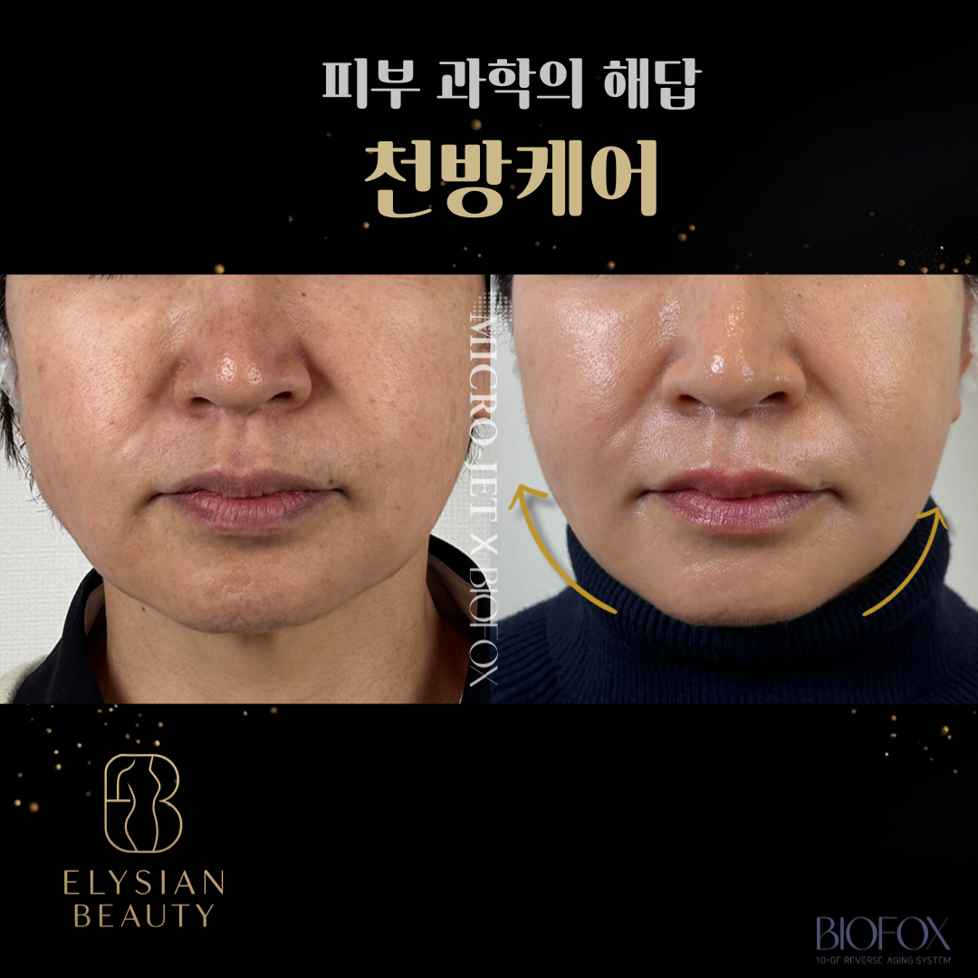 엘리시안뷰티 & 셀스테틱 정자점 photo 10