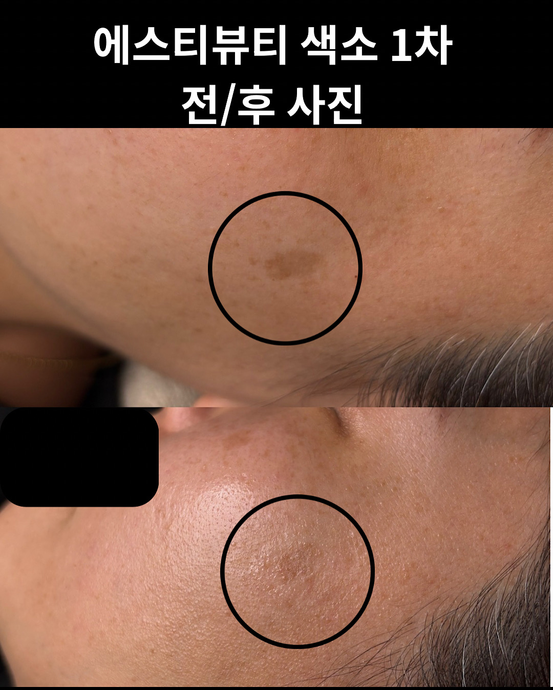 에스티뷰티 photo 5