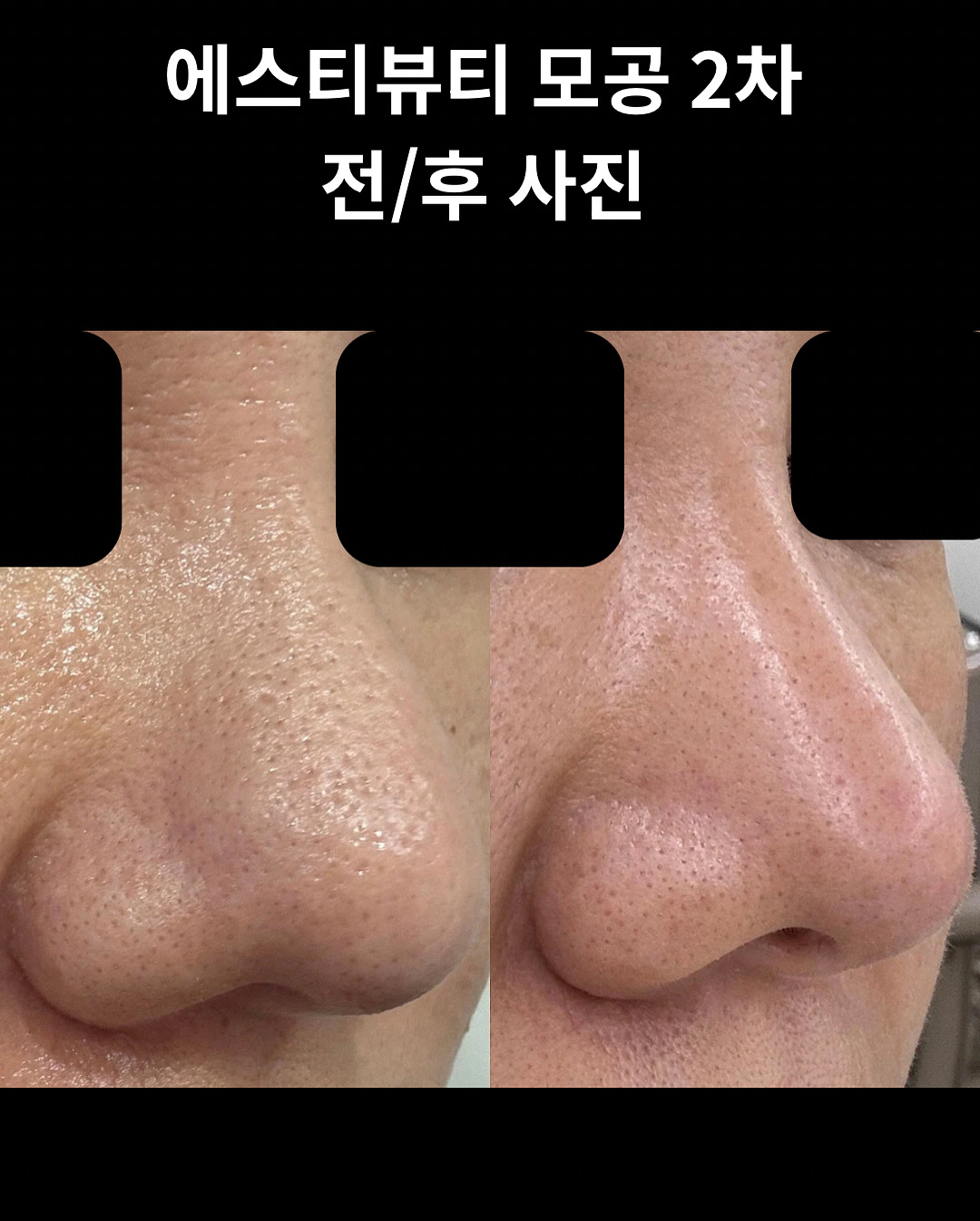에스티뷰티 photo 3