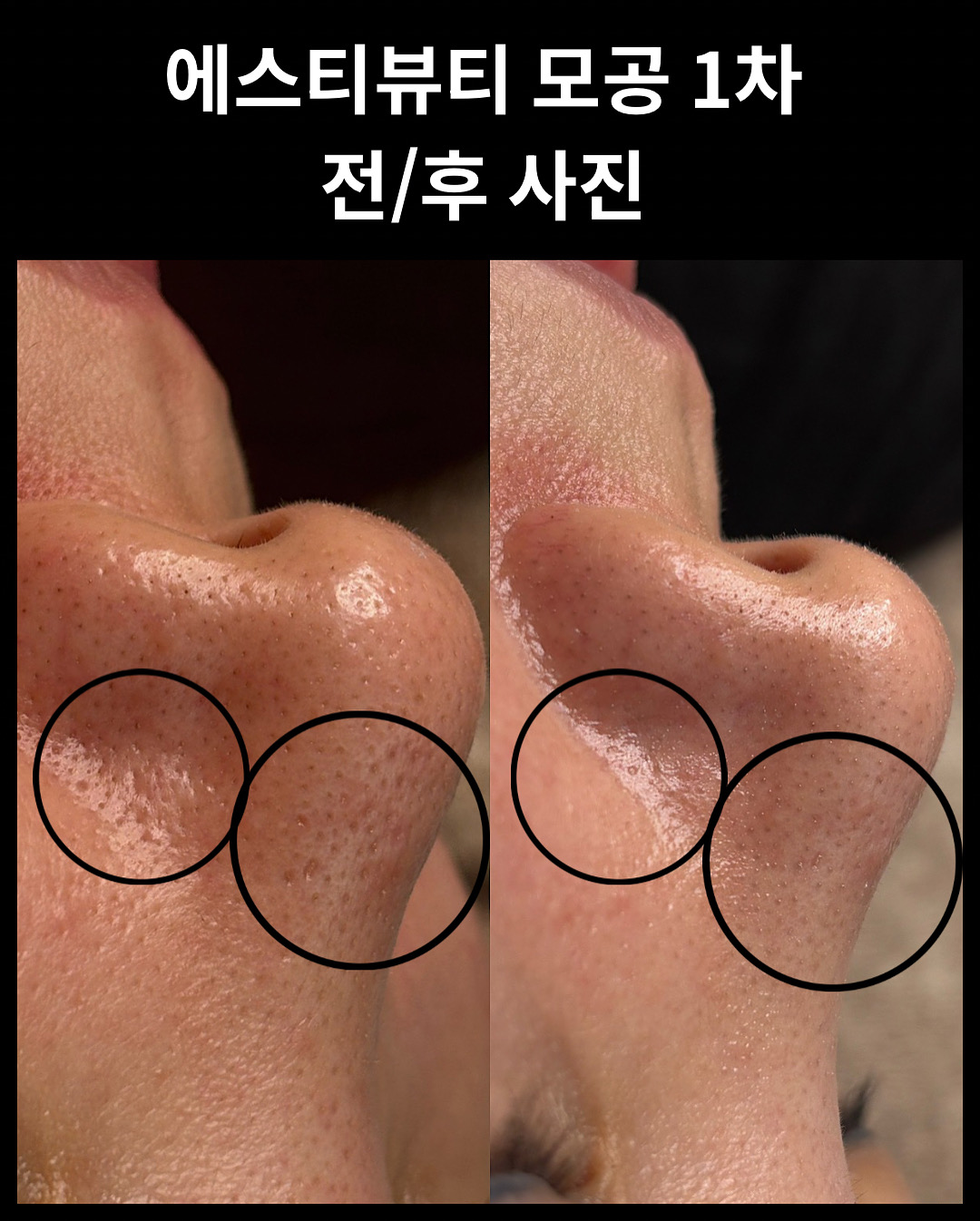 에스티뷰티 photo 4