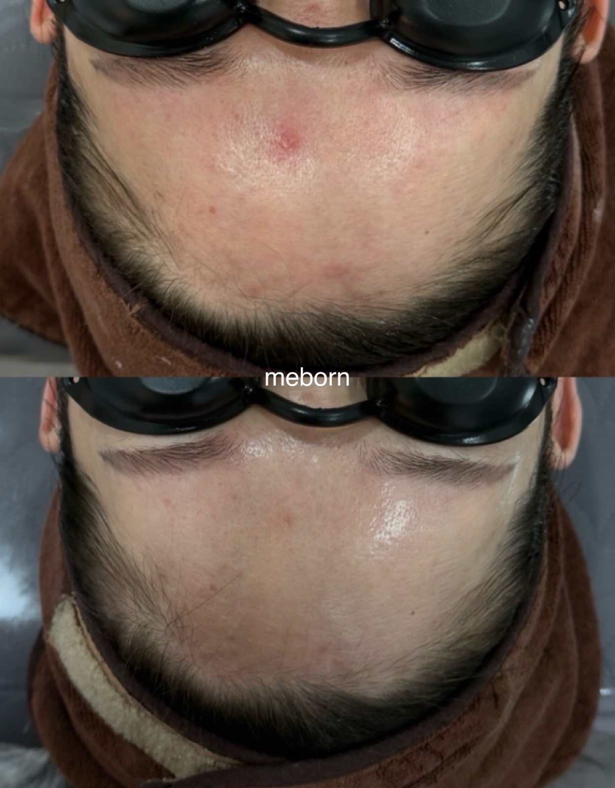 미본에스테틱 대표 이미지