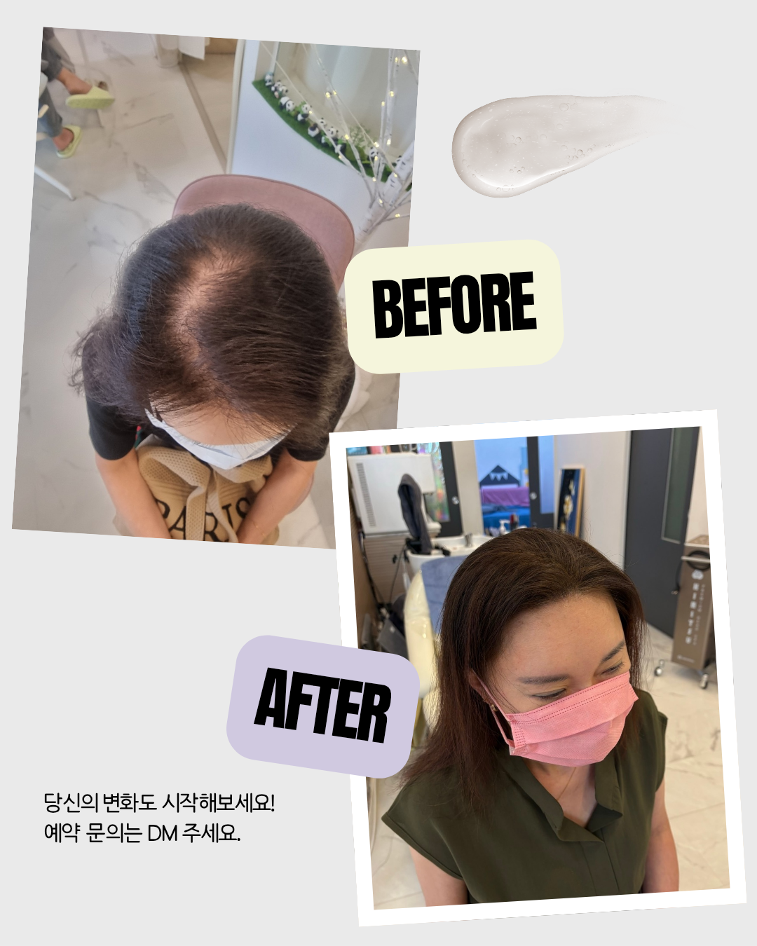 에테르노 대표 이미지