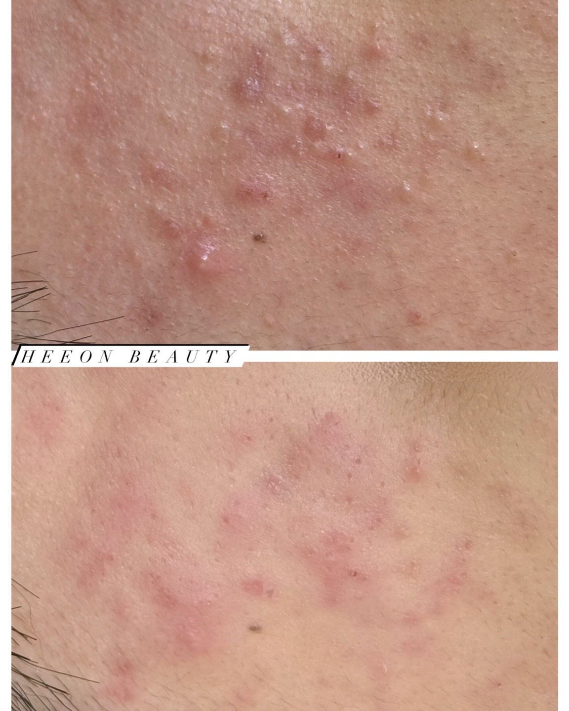 희온뷰티 대표 이미지