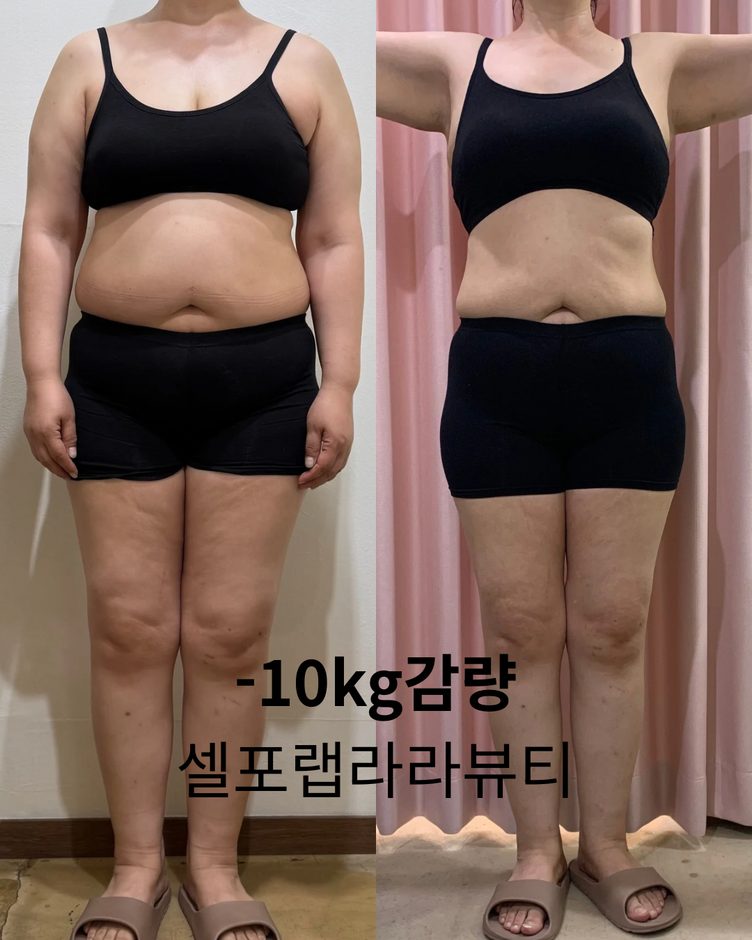 셀포랩 라라뷰티 대표 이미지