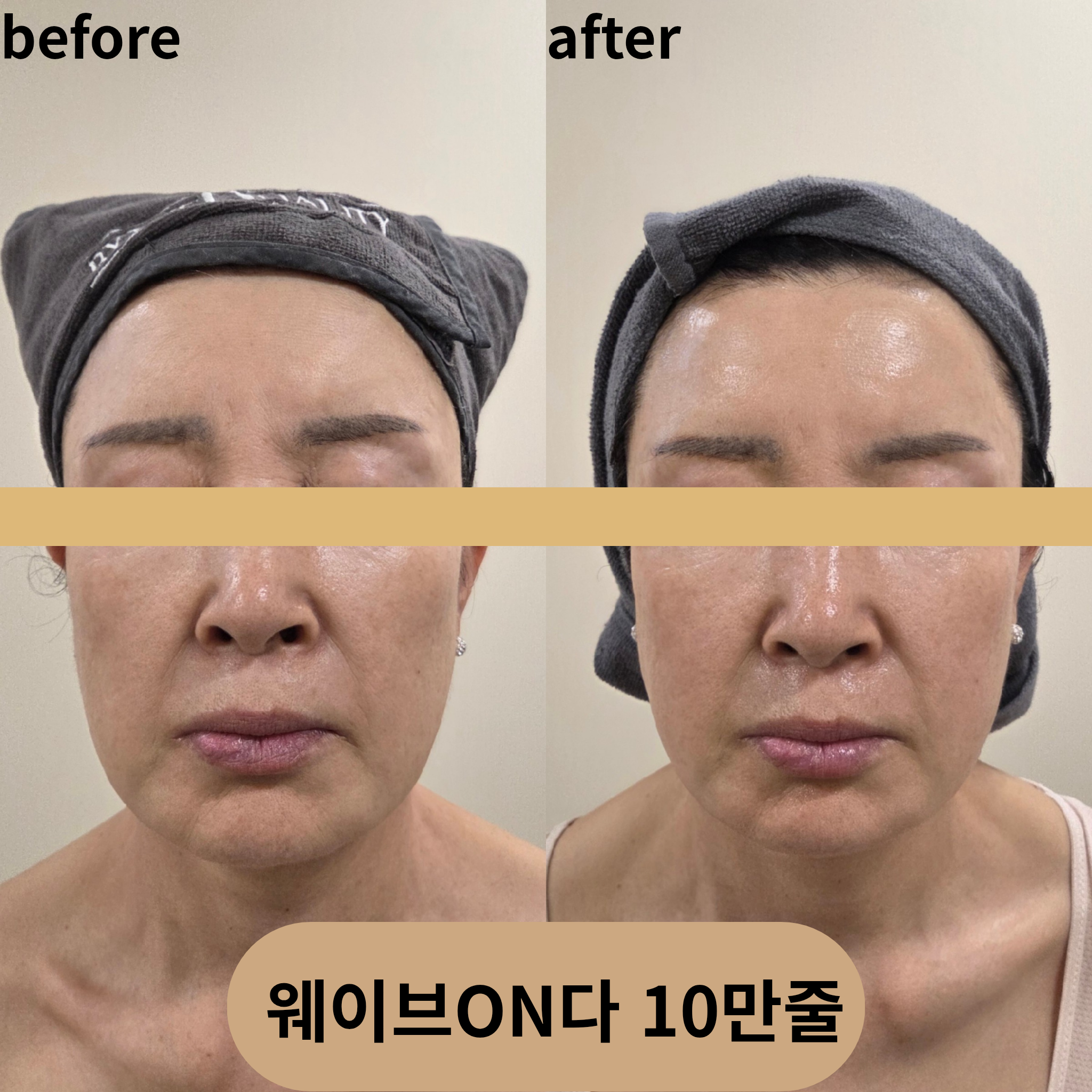 미엘르지스킨 대표 이미지