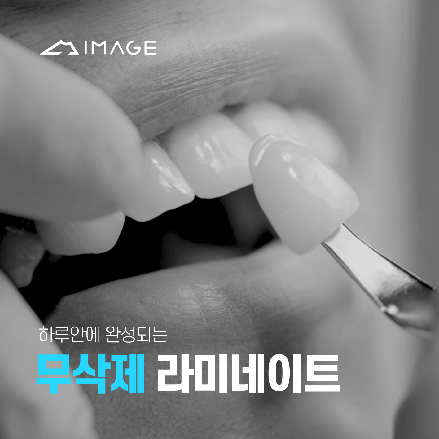 이미지치과의원 대표 이미지