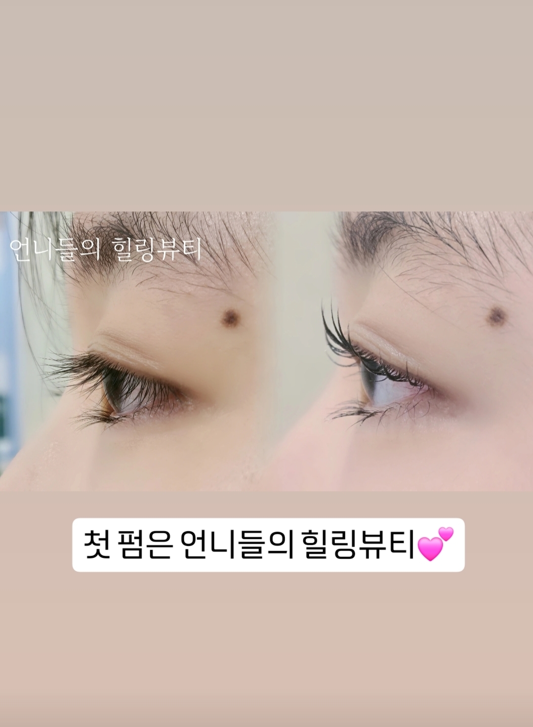 언니들의 힐링뷰티 photo 7