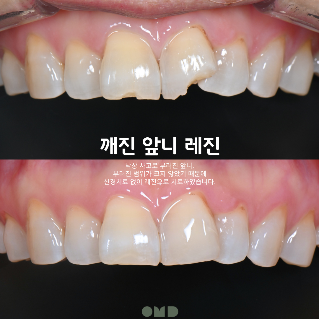 이보다치과 부천본원 내부 전경