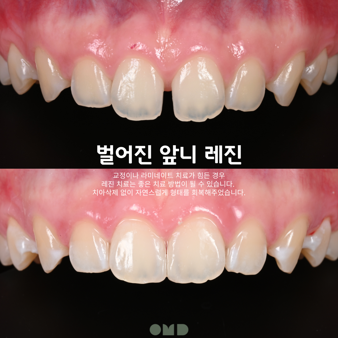 이보다치과 대표 이미지