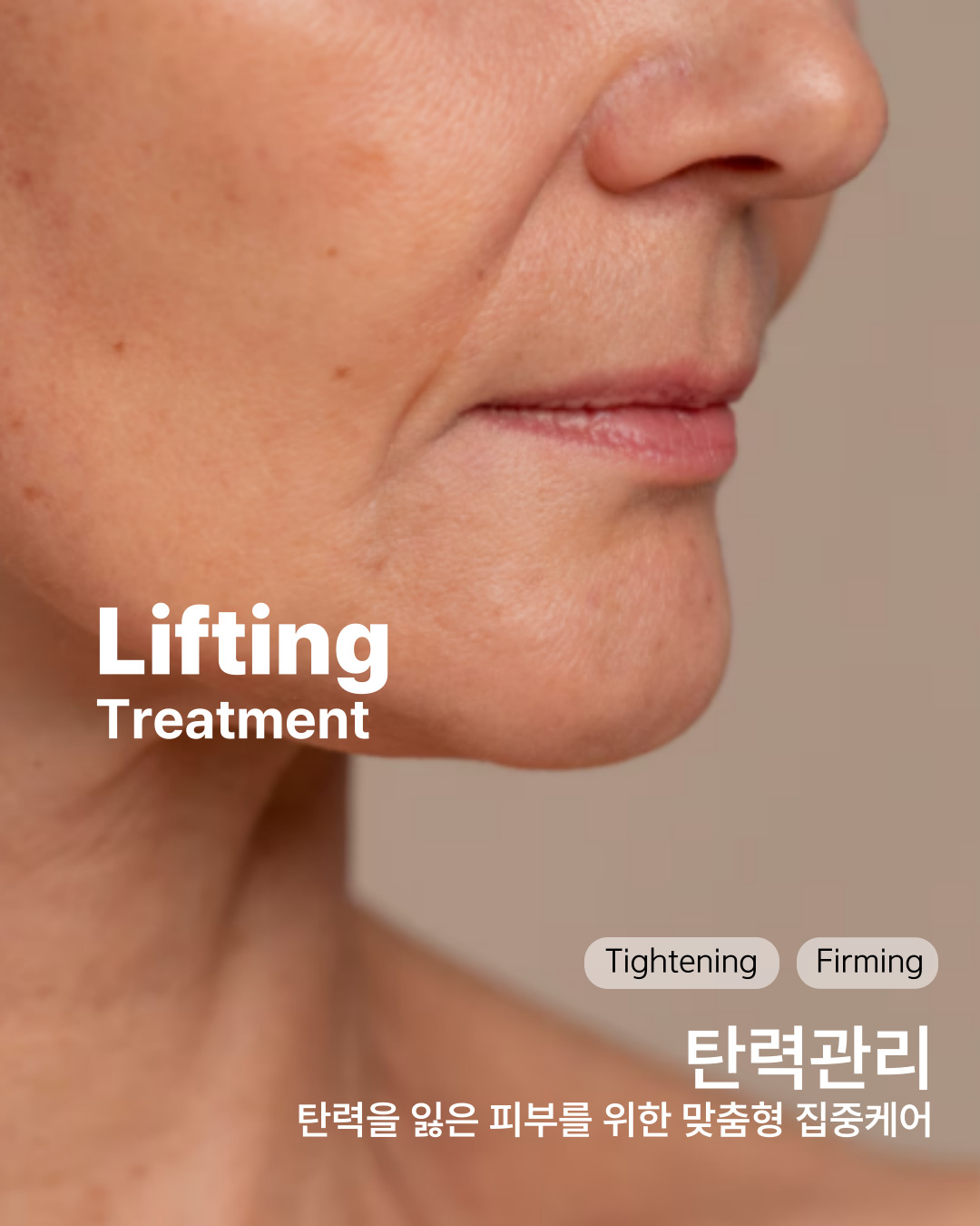루미온 대표 이미지