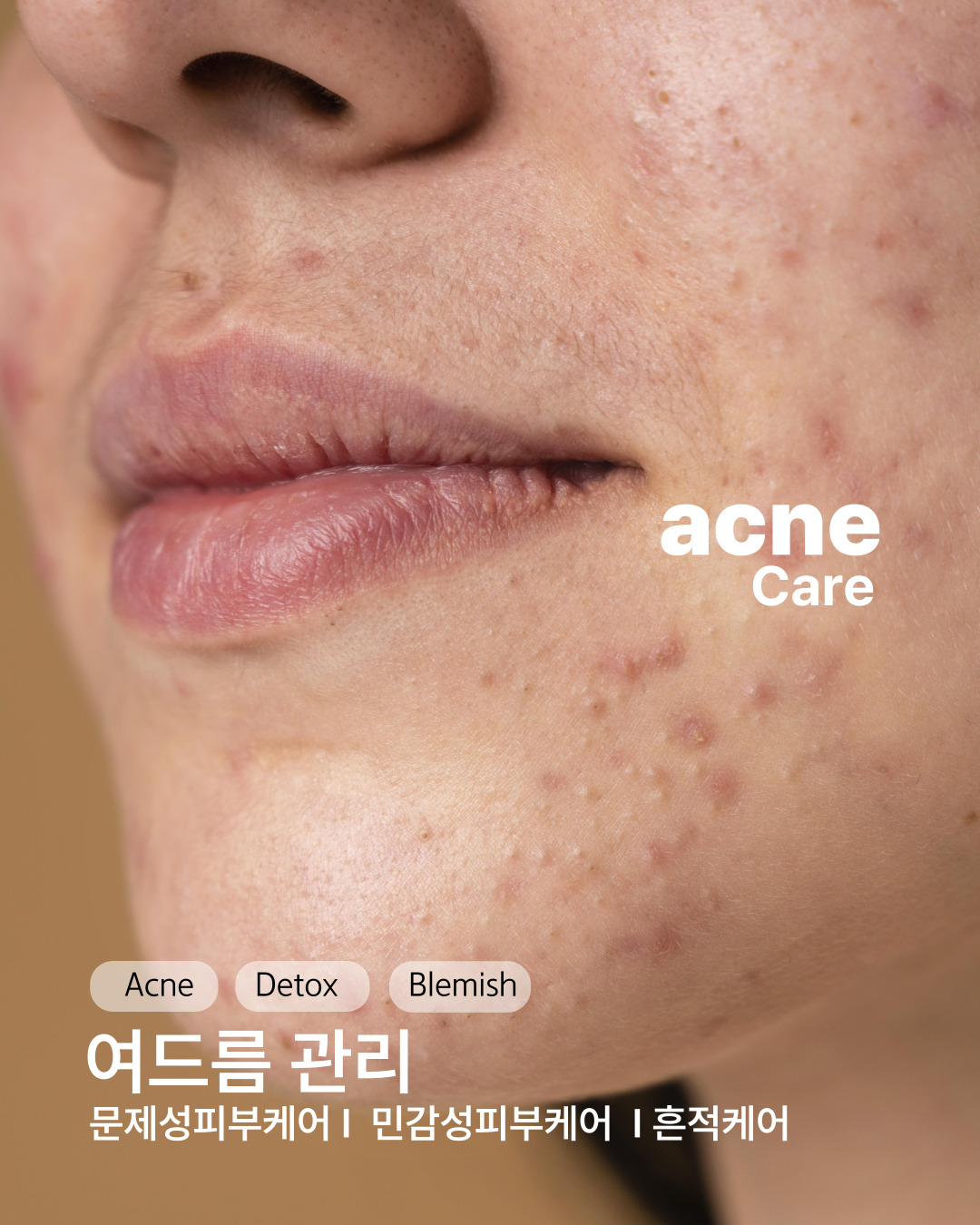 루미온 대표 이미지