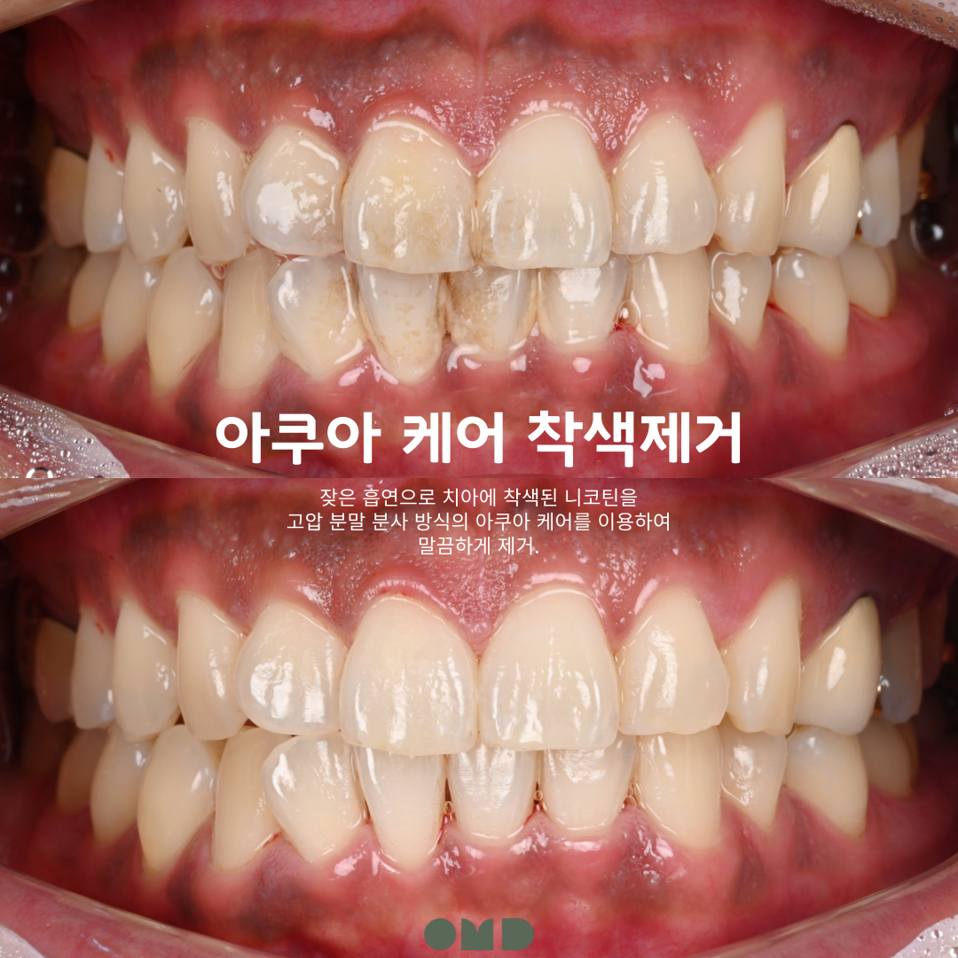 이보다치과 대표 이미지