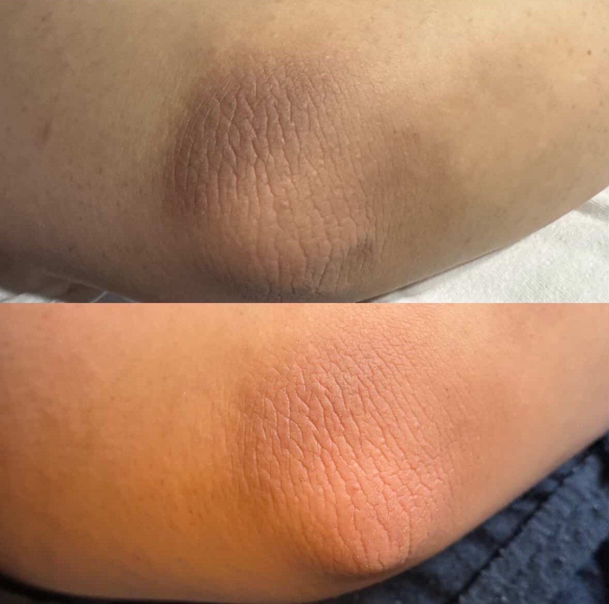 샤인미가 대표 이미지