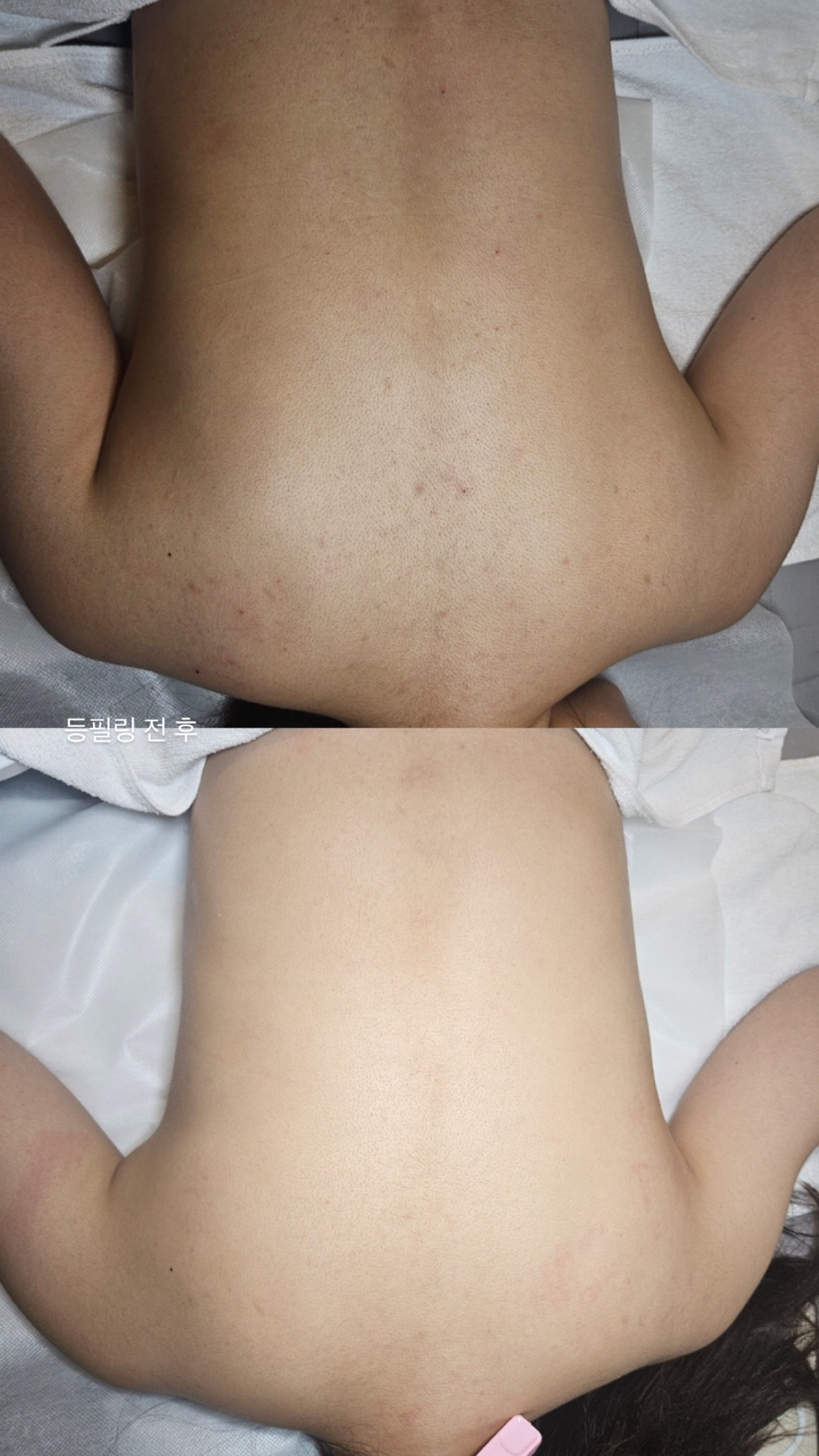 올스킨 대표 이미지