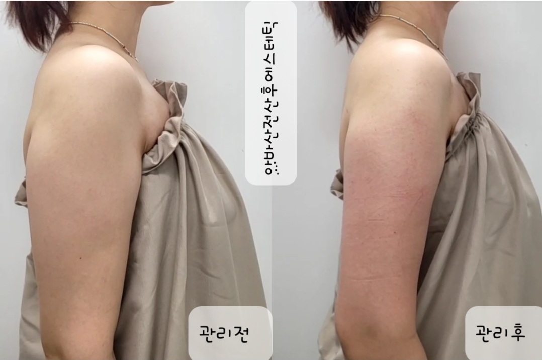 아바산전산후에스테틱 대표 이미지