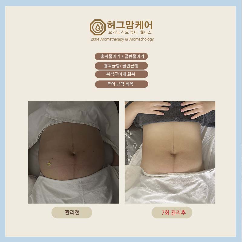 허그맘케어 photo 3