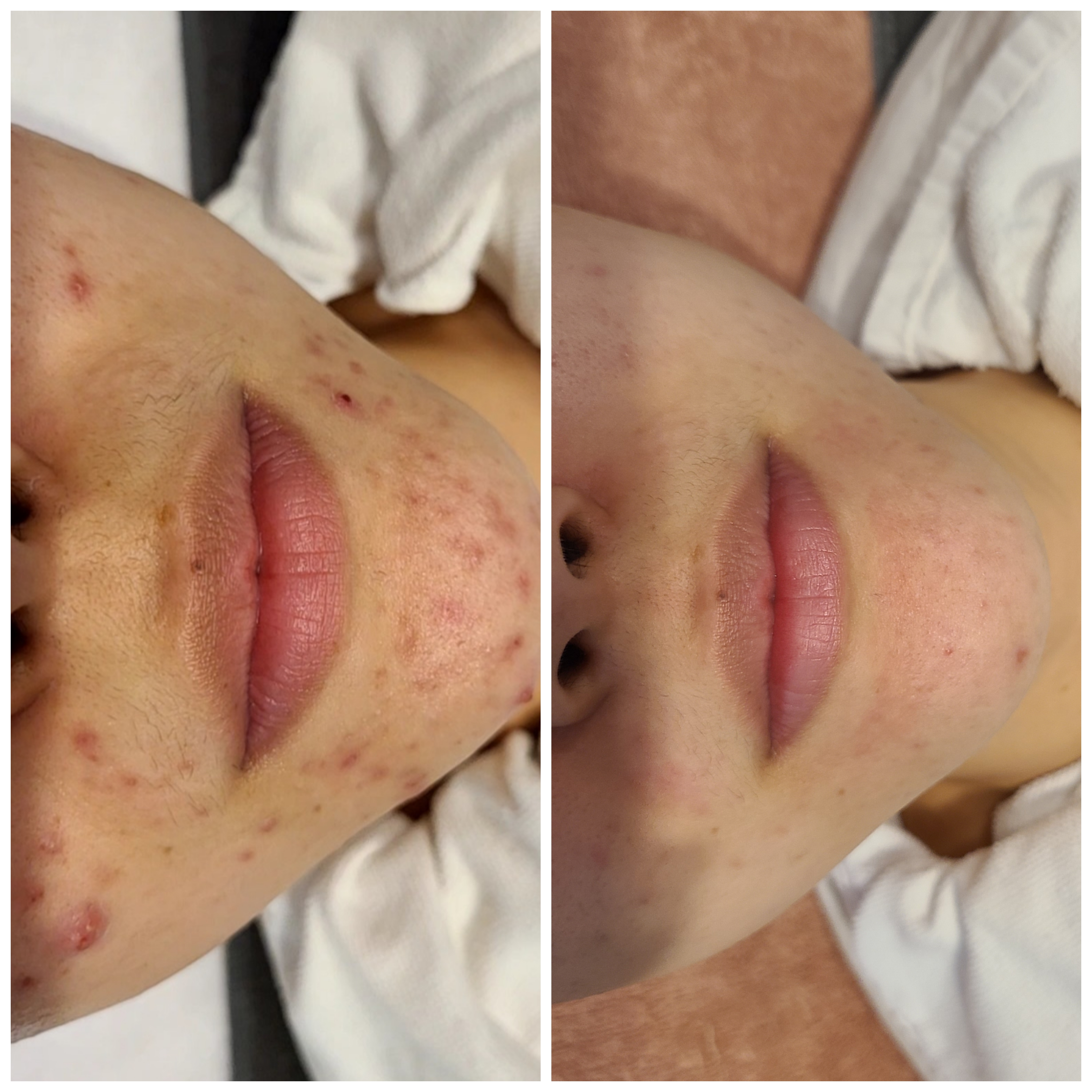 아이미스킨케어 대표 이미지