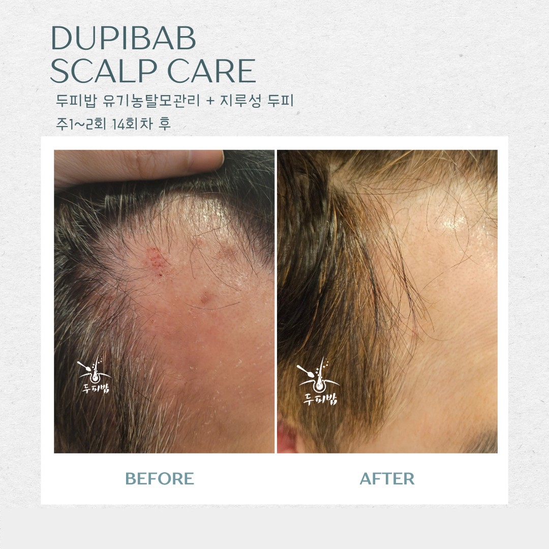 두피밥 인천점 대표 이미지
