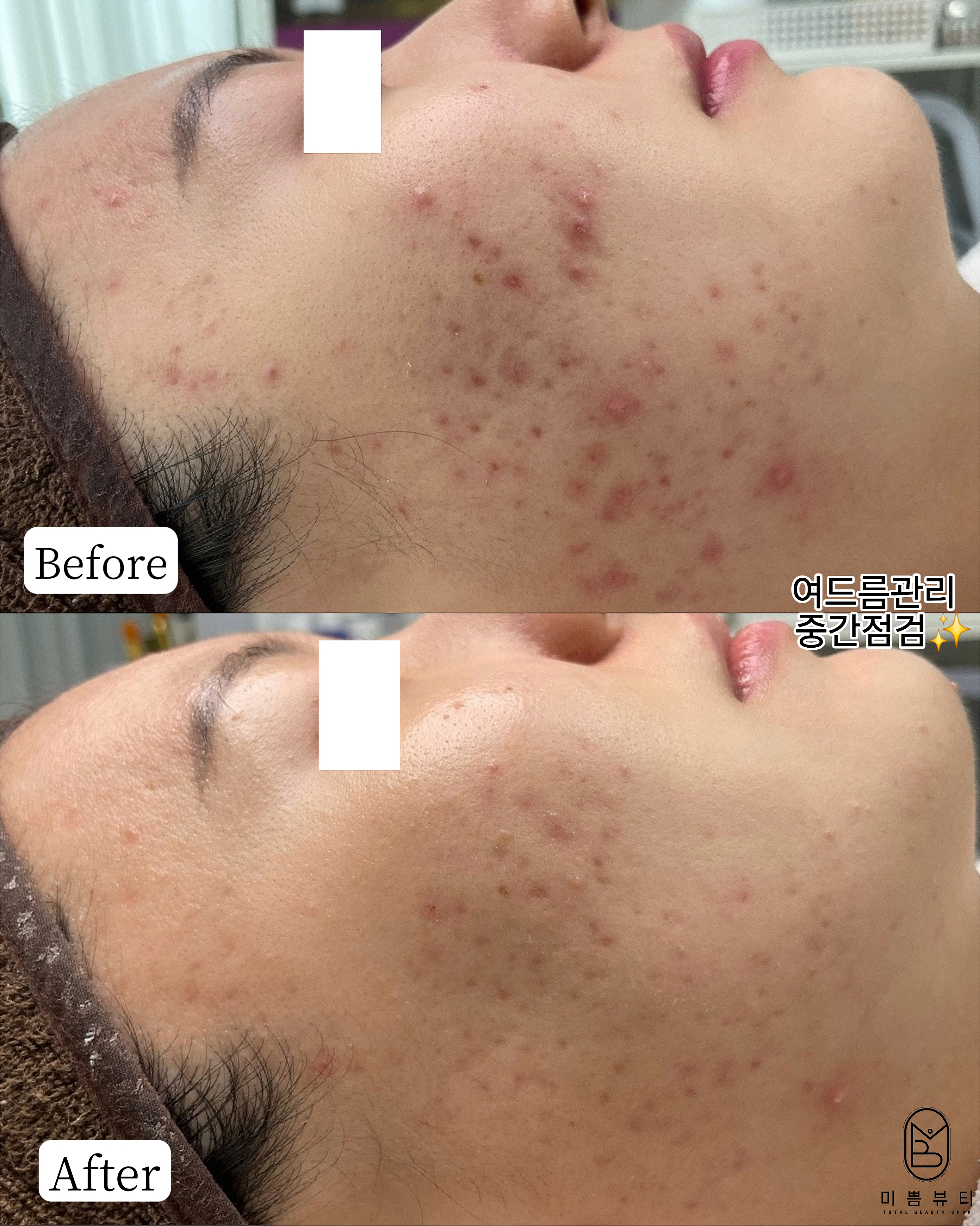 미쁨뷰티 대표 이미지