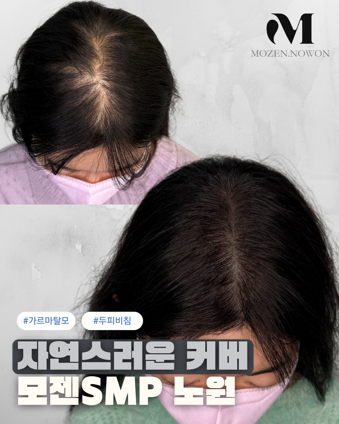 모젠SMP 노원 대표 이미지