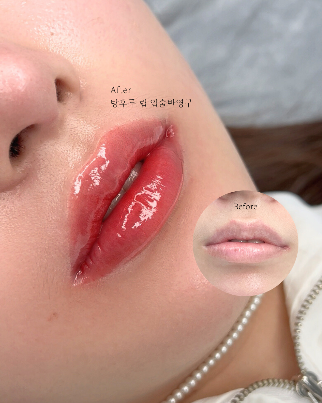 톡스앤필브로우 강남눈썹반영구두피문신 강남본점 대표 이미지