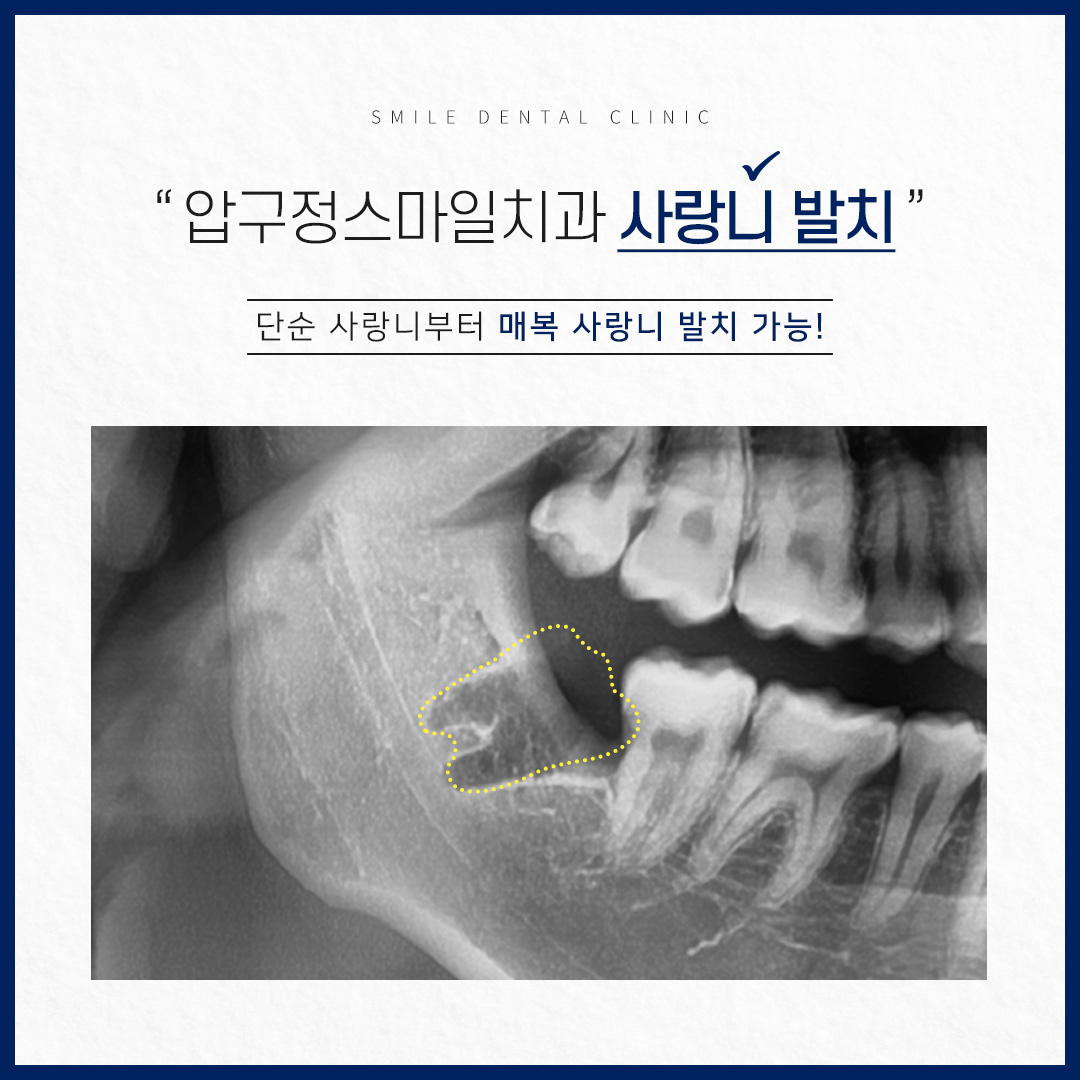 압구정스마일치과의원 대표 이미지